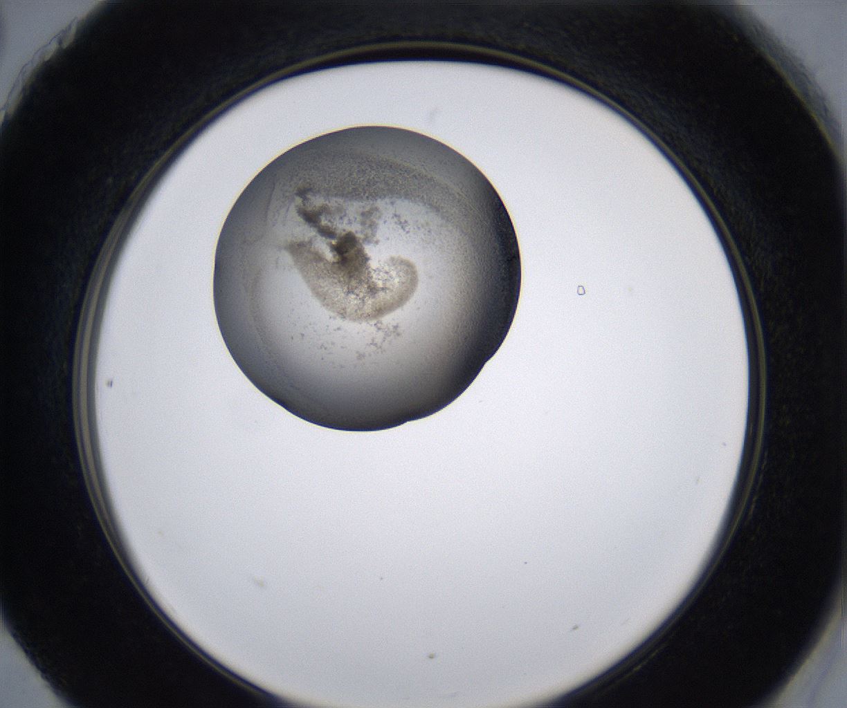 folderID215_plateID2215_batchID10049_wellNum90_profileID1_d2_r150890_ef.jpg