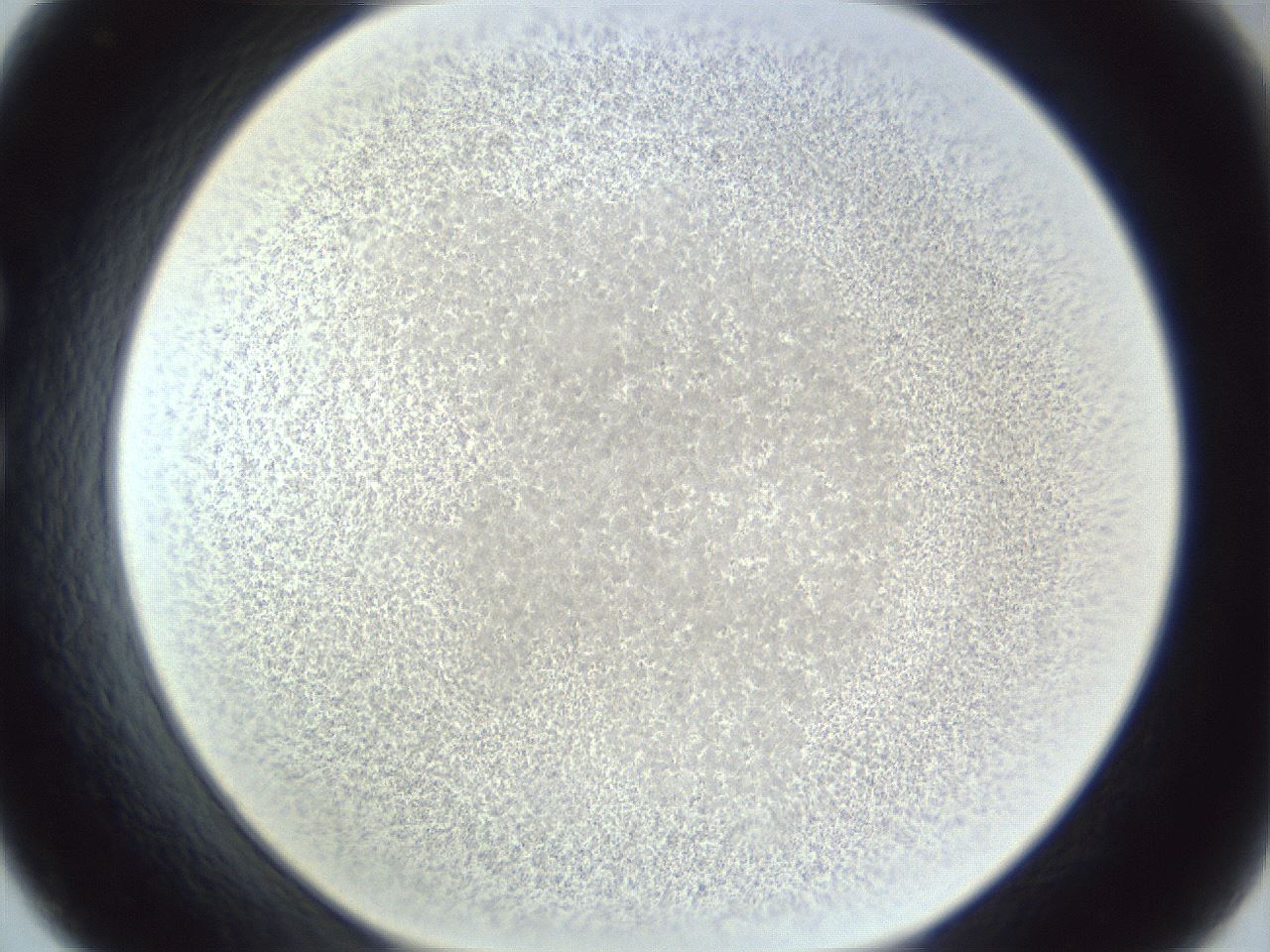 folderID216_plateID1216_batchID3622_wellNum33_profileID1_d1_r68160_ef.jpg