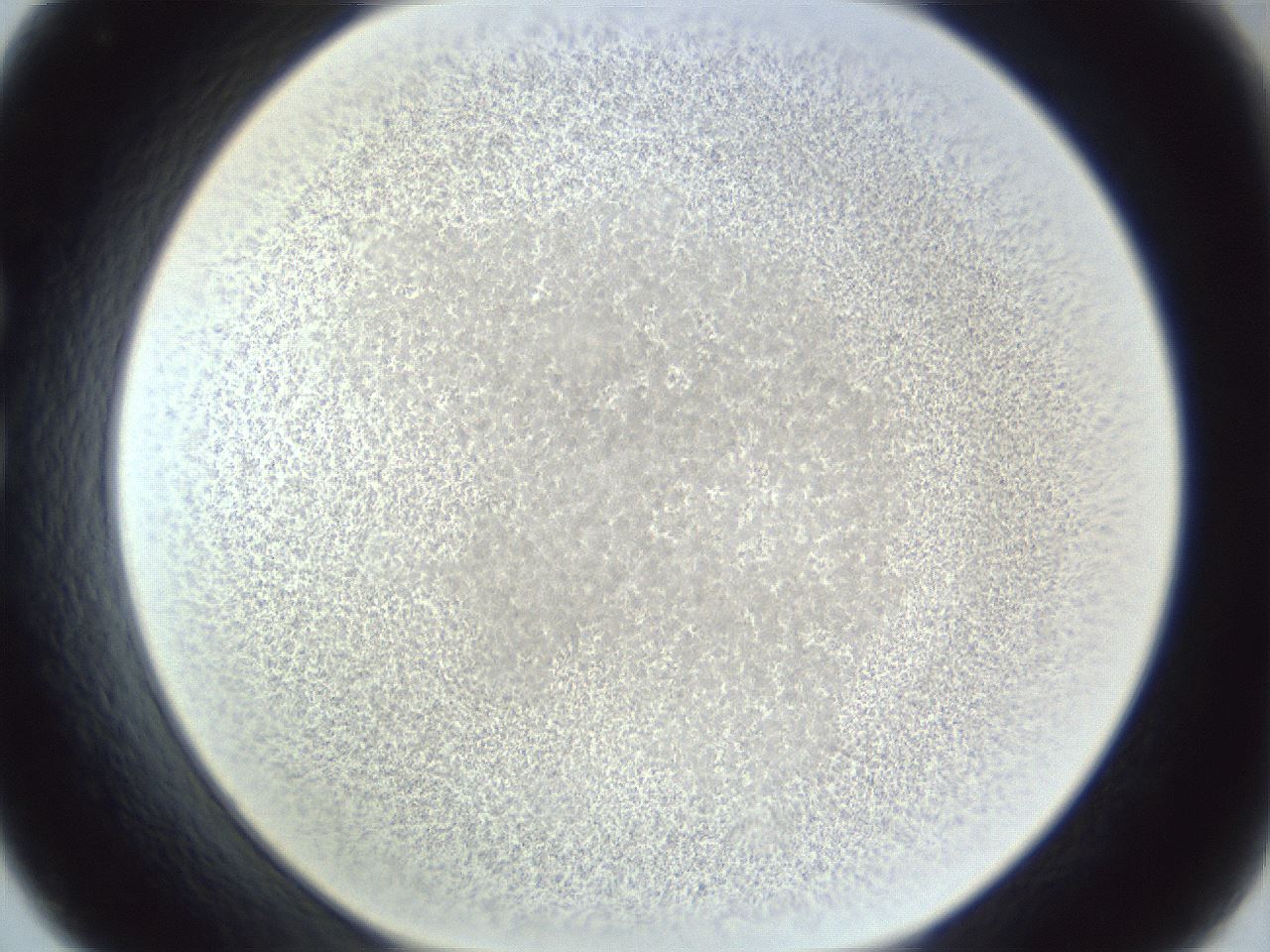 folderID216_plateID1216_batchID3656_wellNum33_profileID1_d1_r68160_ef.jpg