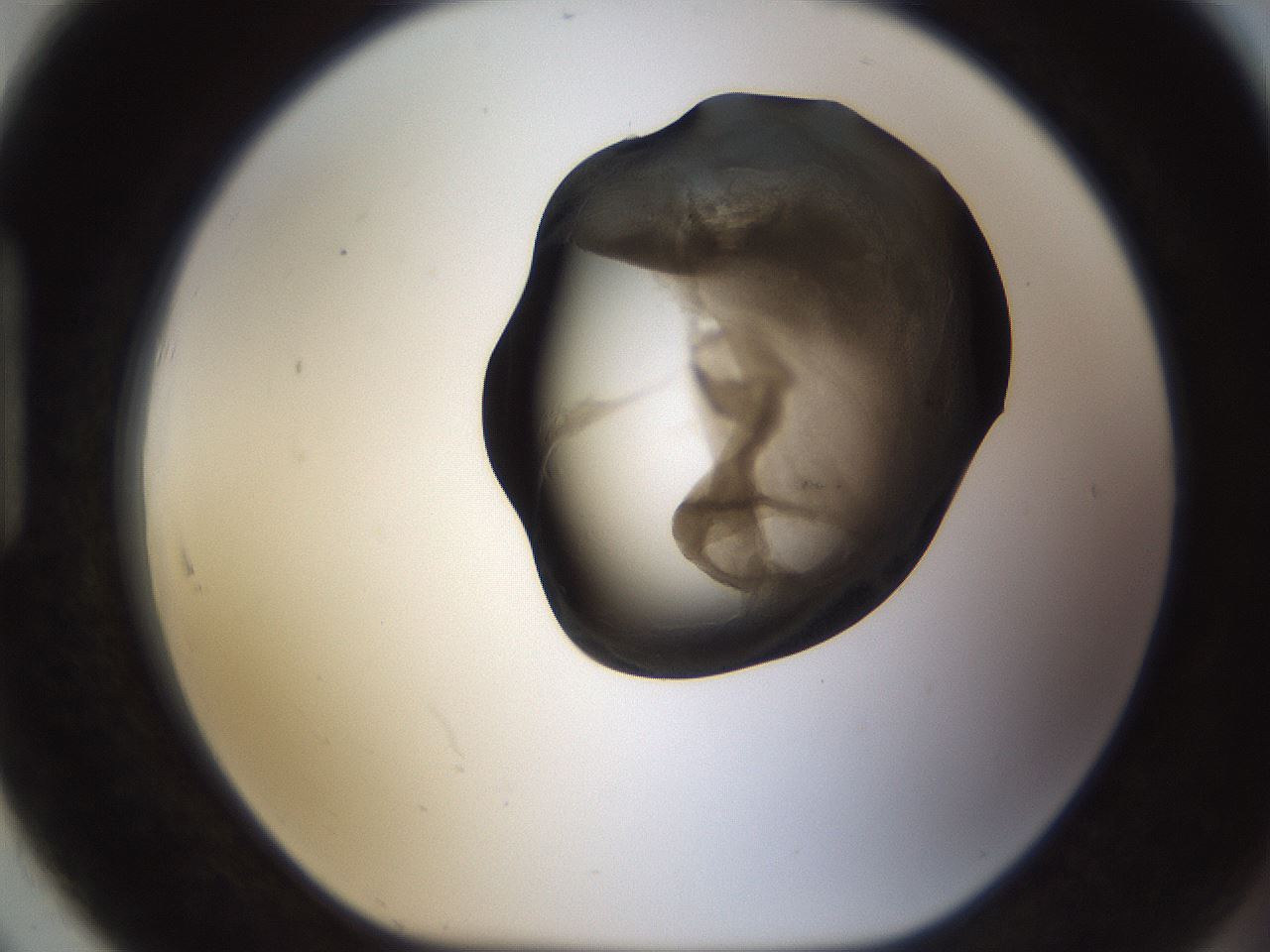folderID228_plateID1228_batchID3780_wellNum91_profileID1_d1_r70394_ef.jpg