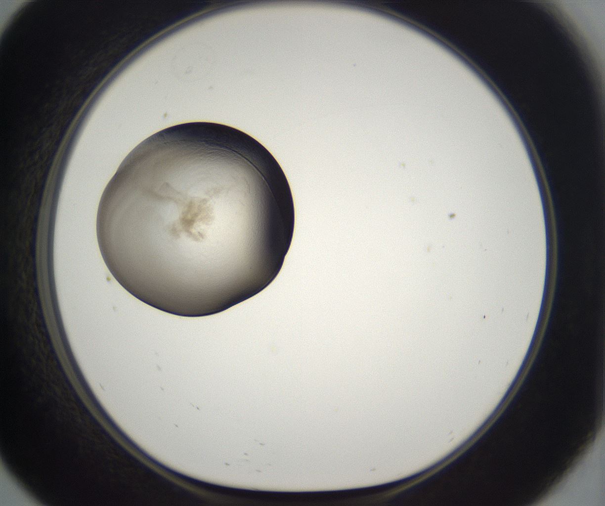 folderID229_plateID2229_batchID10100_wellNum57_profileID1_d1_r154187_ef.jpg