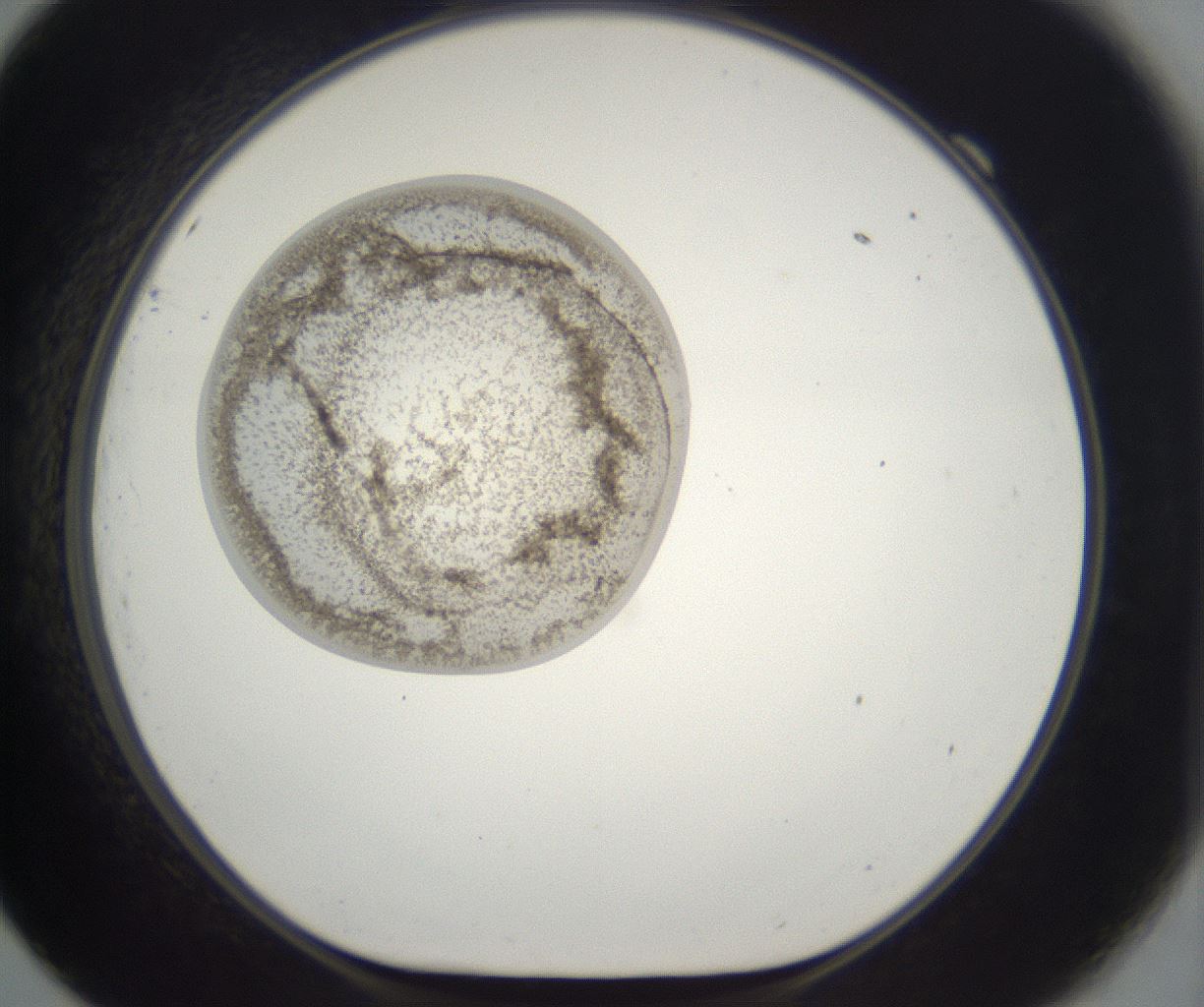 folderID229_plateID2229_batchID10100_wellNum69_profileID1_d1_r154211_ef.jpg