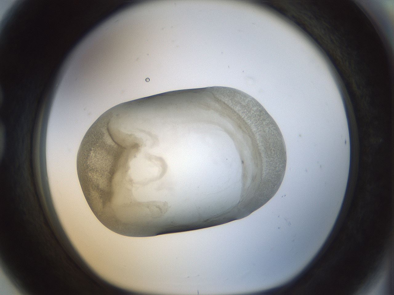 folderID22_plateID1022_batchID1895_wellNum80_profileID1_d1_r43635_ef.jpg