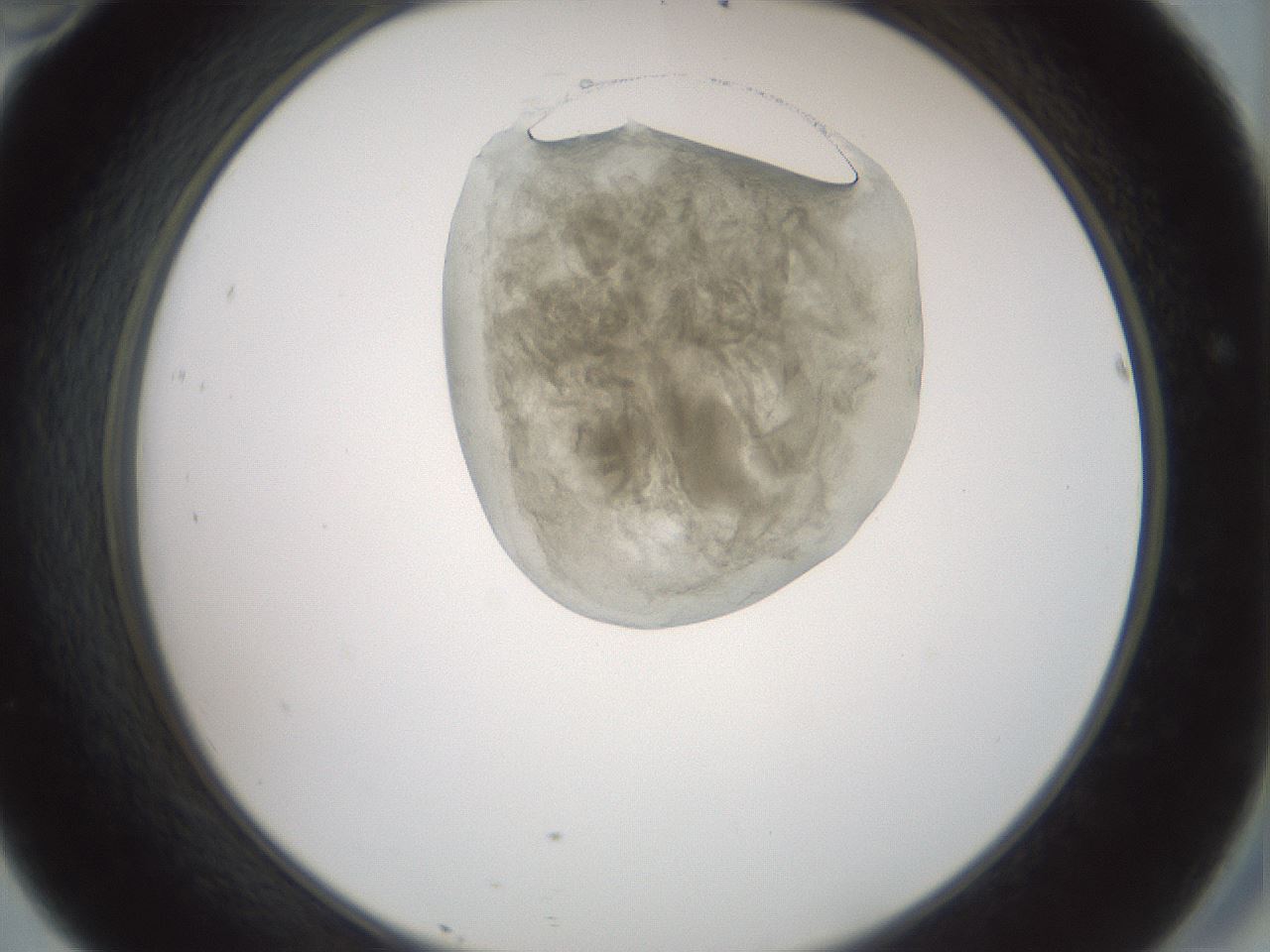 folderID230_plateID1230_batchID3779_wellNum46_profileID1_d2_r71695_ef.jpg
