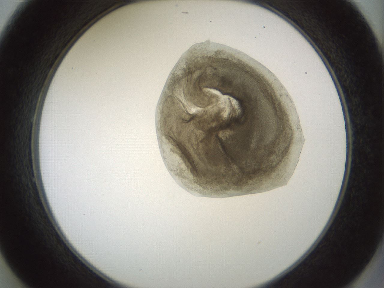 folderID230_plateID1230_batchID3779_wellNum49_profileID1_d2_r71698_ef.jpg