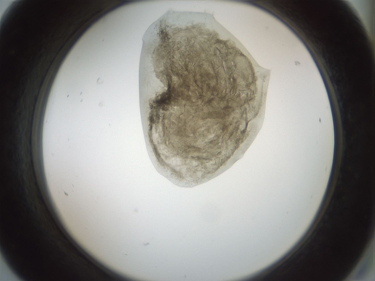 folderID230_plateID1230_batchID3779_wellNum68_profileID1_d2_r71717_ef.jpg