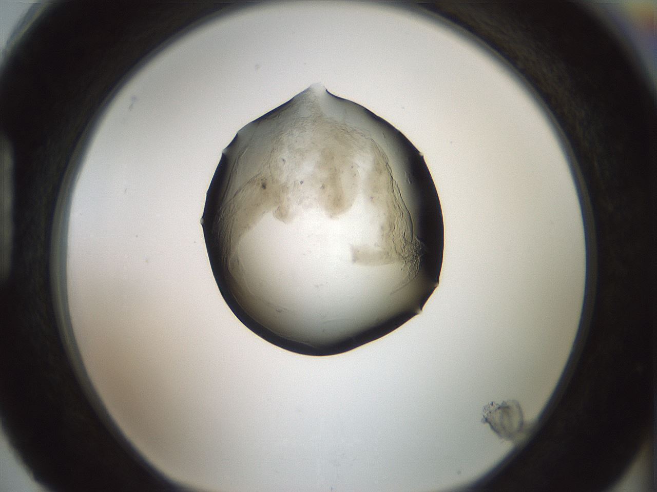 folderID230_plateID1230_batchID3779_wellNum88_profileID1_d1_r70295_ef.jpg