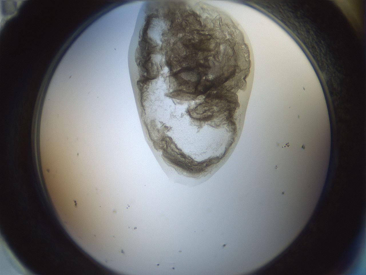 folderID230_plateID1230_batchID3779_wellNum95_profileID1_d2_r71744_ef.jpg