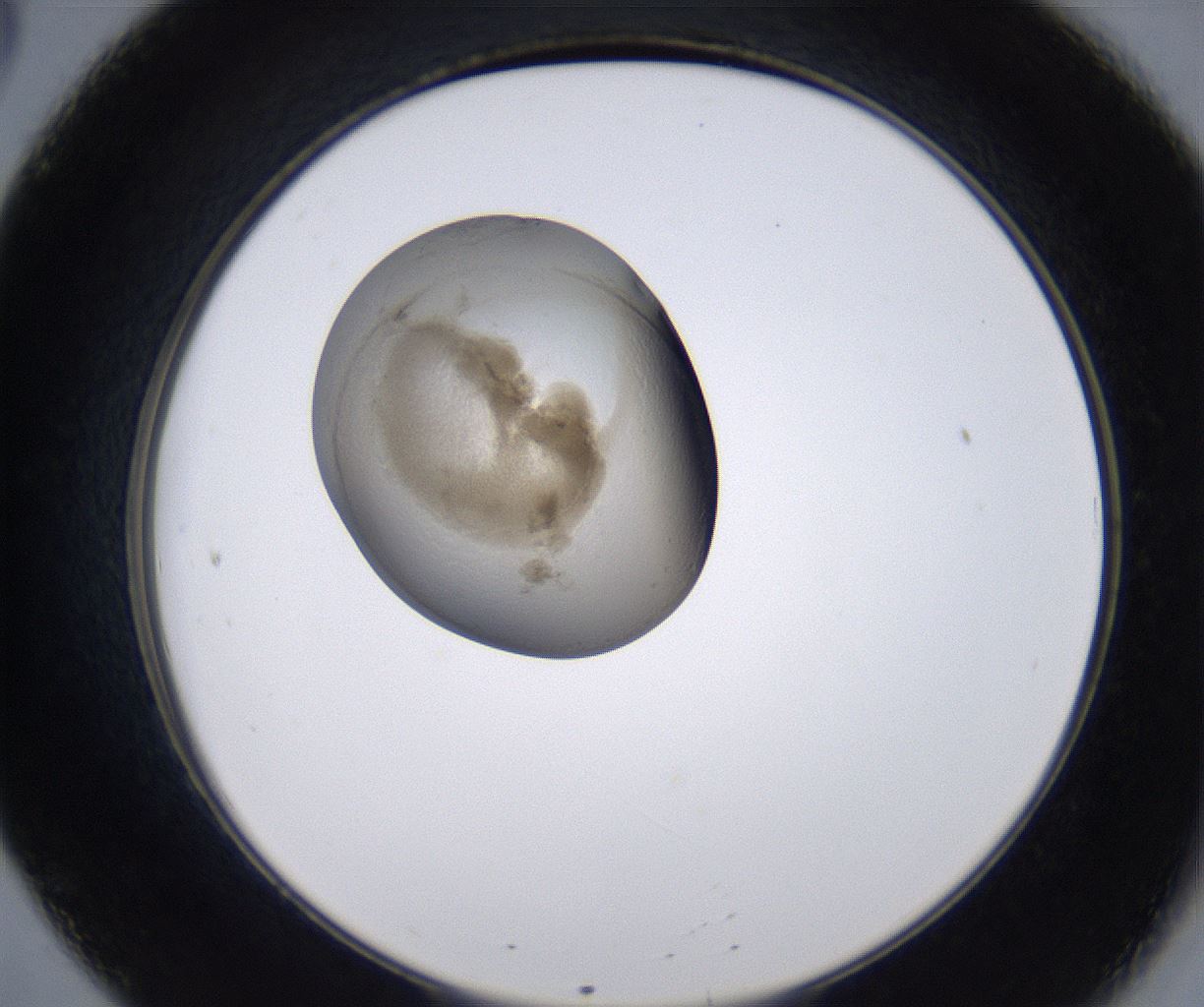 folderID230_plateID2230_batchID10094_wellNum20_profileID1_d2_r153154_ef.jpg