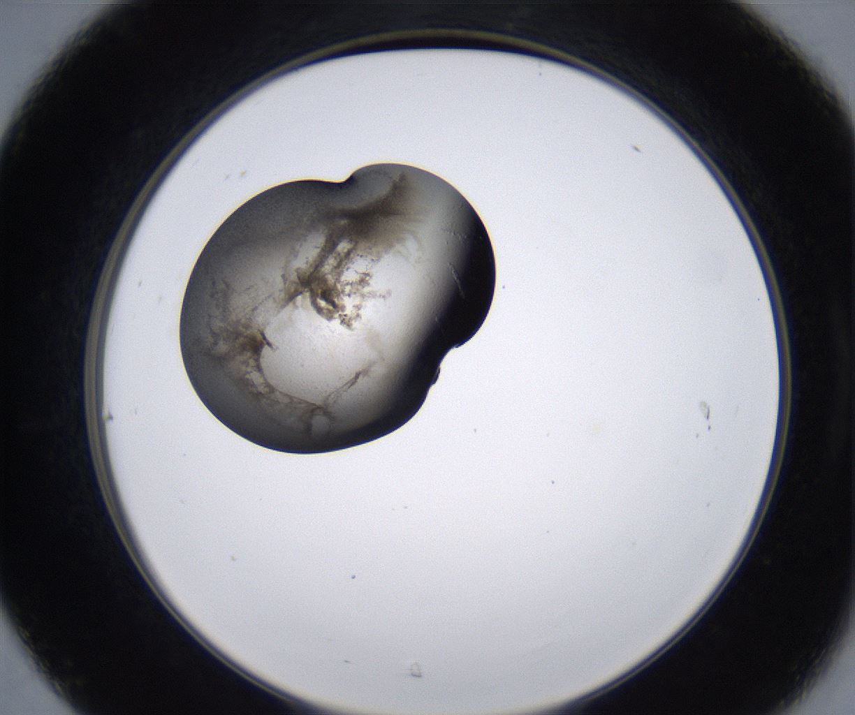 folderID230_plateID2230_batchID10094_wellNum31_profileID1_d2_r153176_ef.jpg