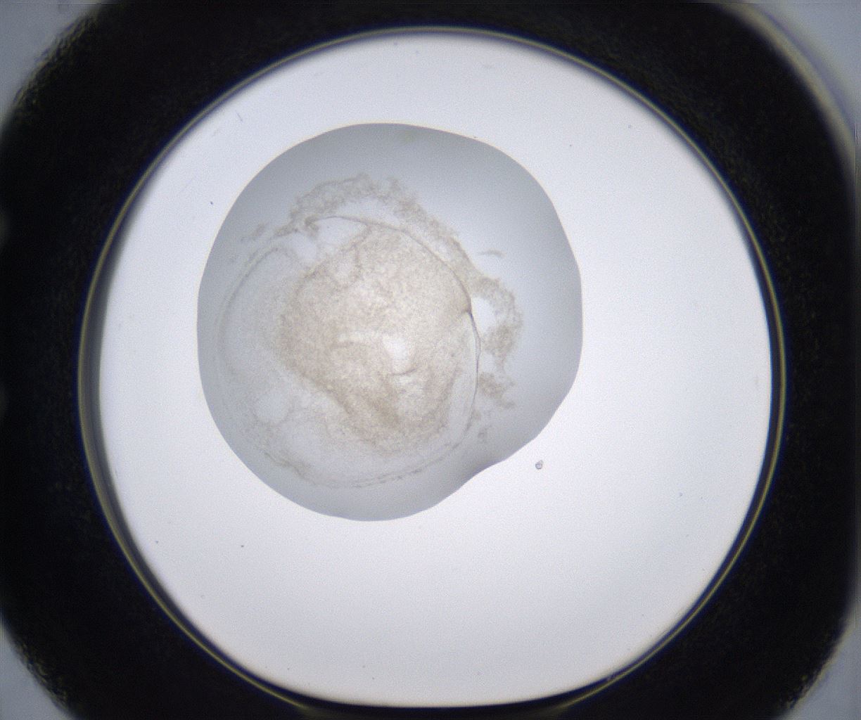 folderID230_plateID2230_batchID10094_wellNum50_profileID1_d1_r153213_ef.jpg