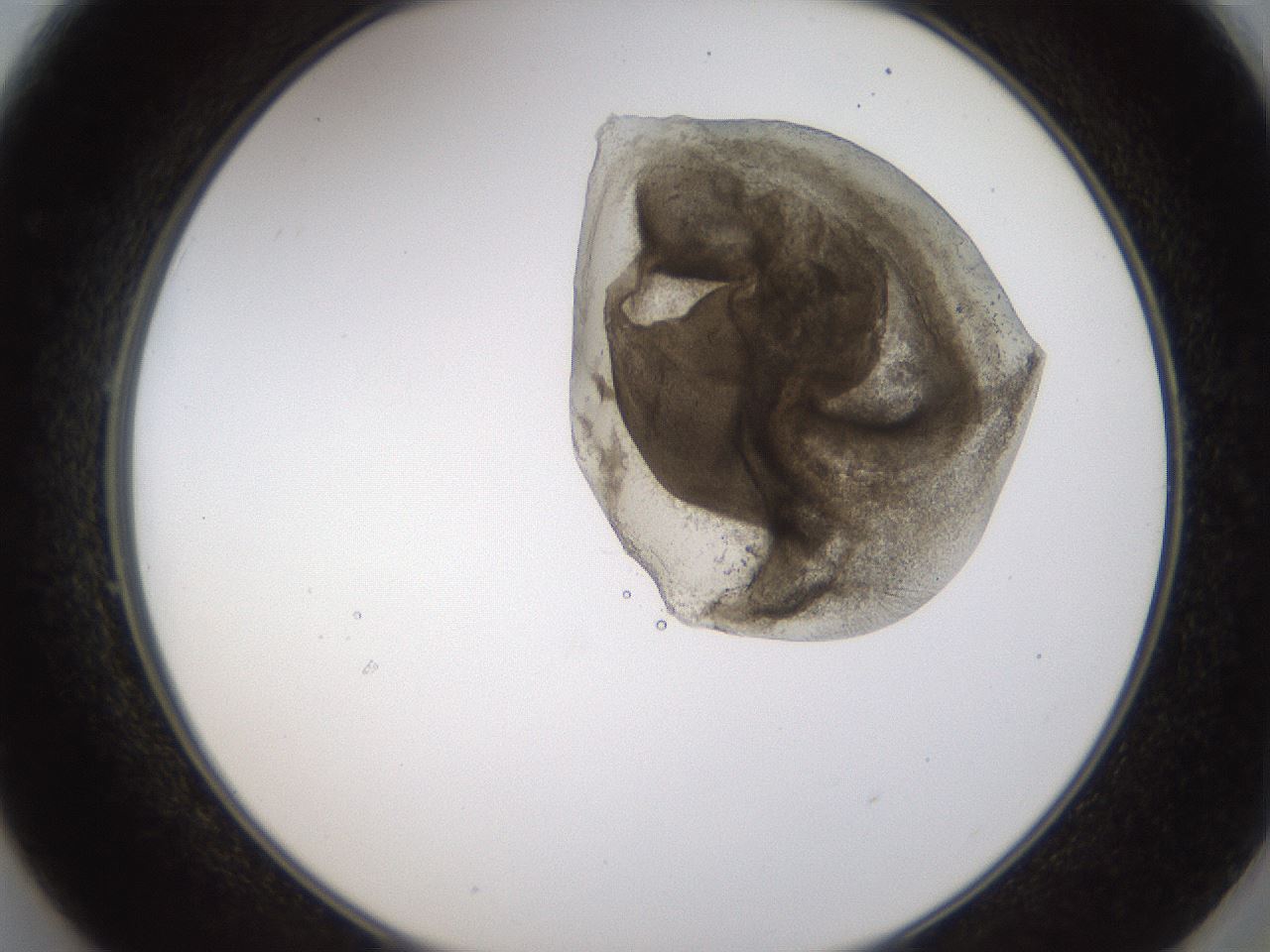 folderID231_plateID1231_batchID3778_wellNum49_profileID1_d2_r71794_ef.jpg