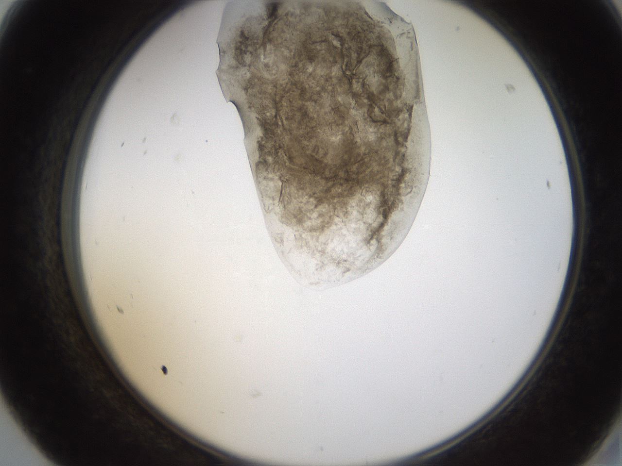 folderID231_plateID1231_batchID3778_wellNum68_profileID1_d2_r71813_ef.jpg