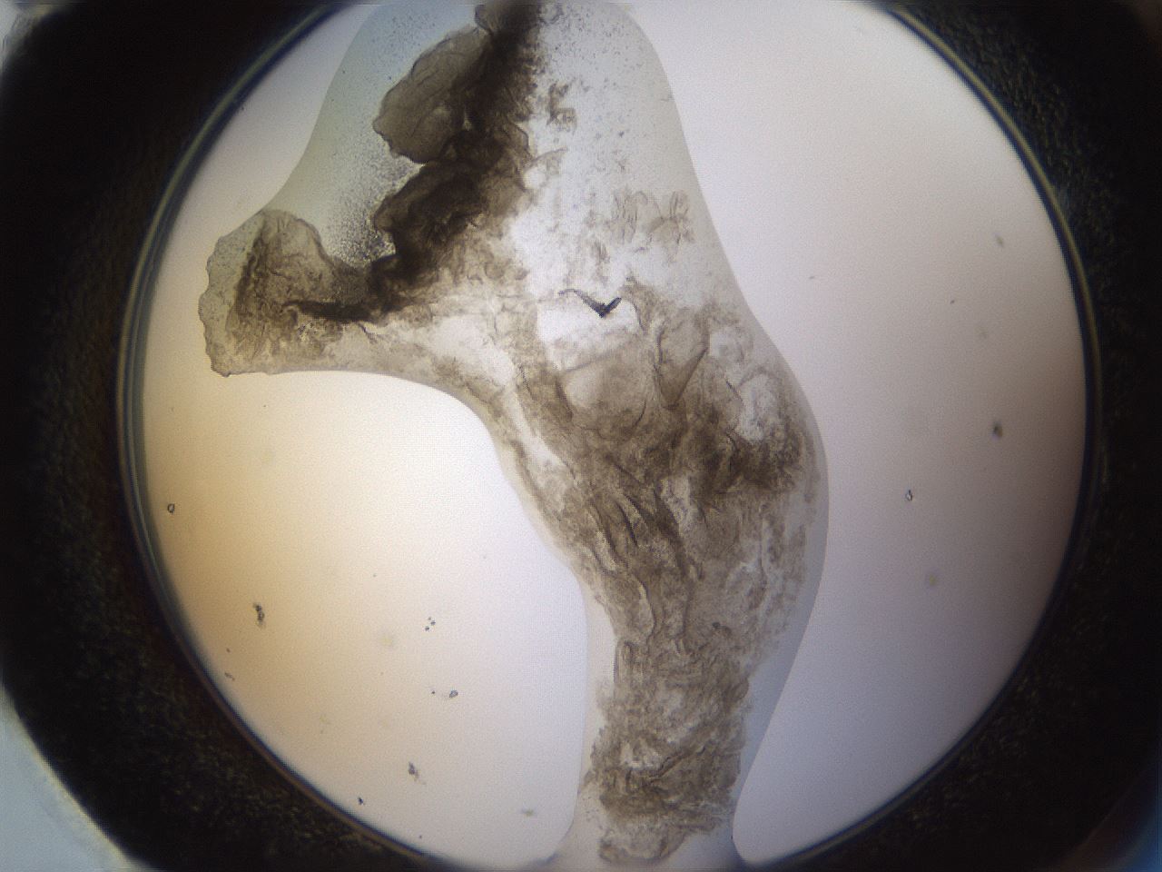 folderID231_plateID1231_batchID3778_wellNum95_profileID1_d2_r71840_ef.jpg