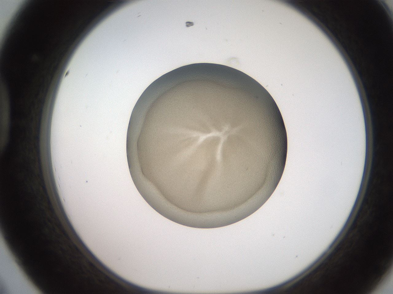 folderID233_plateID2233_batchID10121_wellNum44_profileID1_d1_r154310_ef.jpg