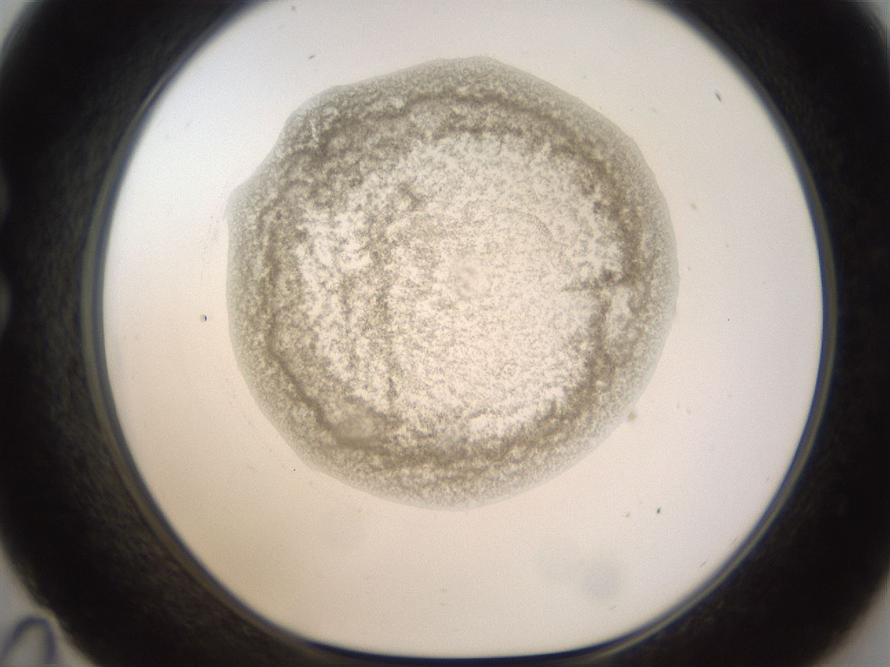folderID238_plateID1238_batchID3807_wellNum35_profileID1_d1_r72068_ef.jpg