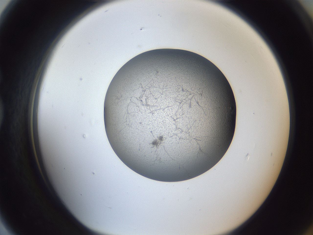 folderID249_plateID1249_batchID3878_wellNum79_profileID1_d1_r72444_ef.jpg