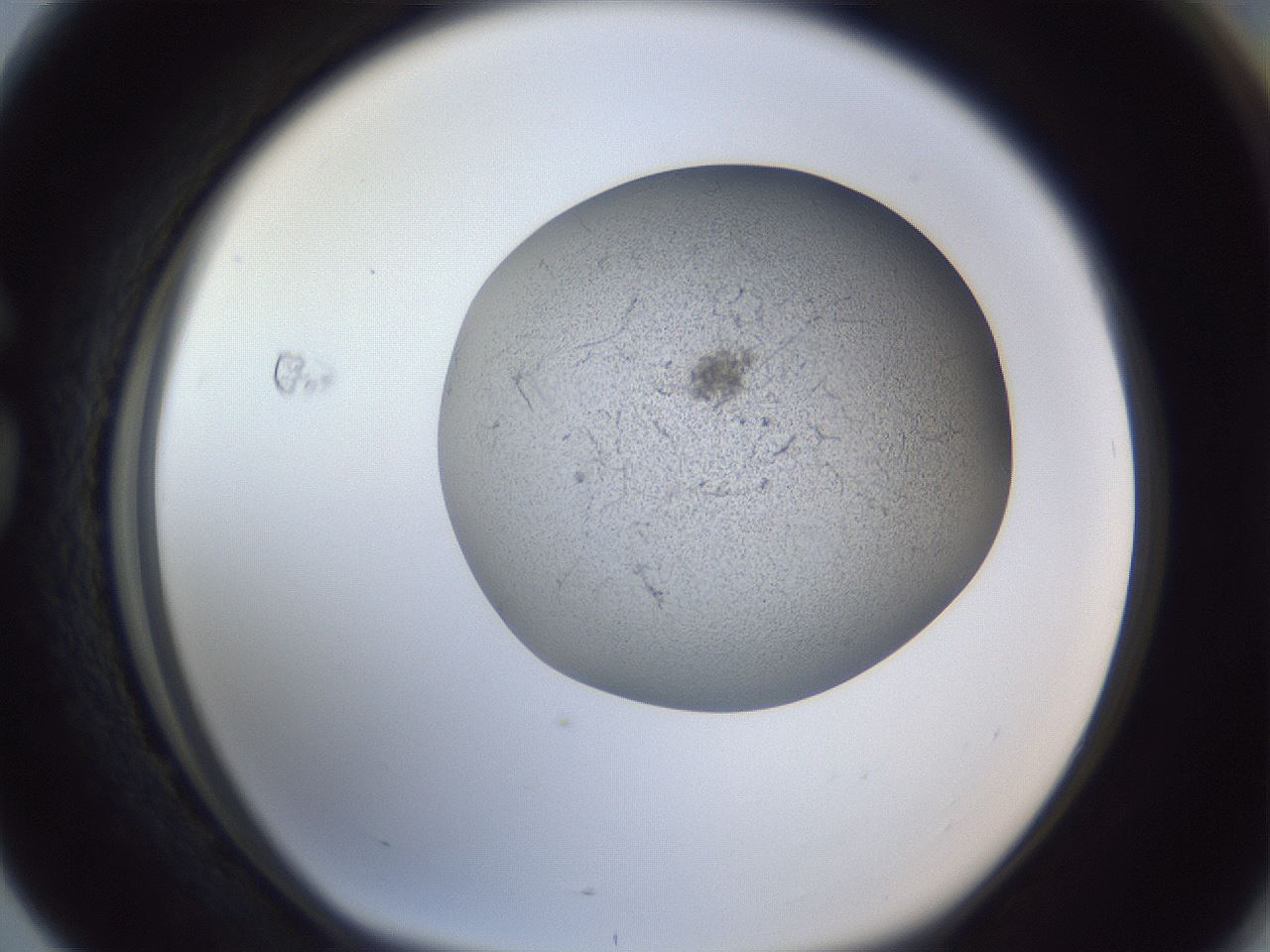 folderID249_plateID1249_batchID3996_wellNum76_profileID1_d1_r72441_ef.jpg