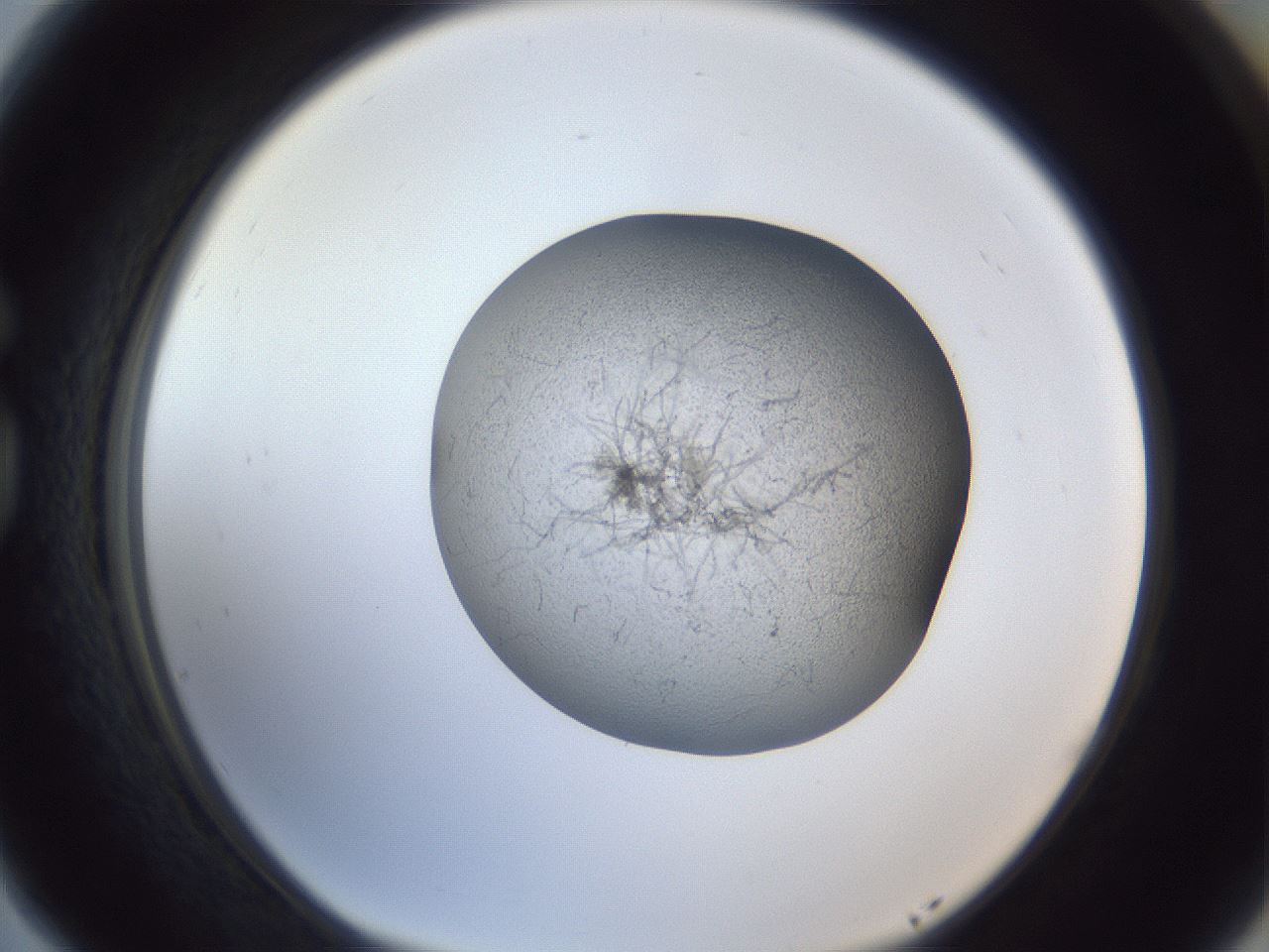 folderID249_plateID1249_batchID3996_wellNum77_profileID1_d1_r72442_ef.jpg