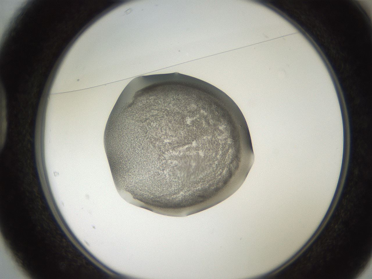 folderID250_plateID2250_batchID10282_wellNum37_profileID1_d1_r155523_ef.jpg