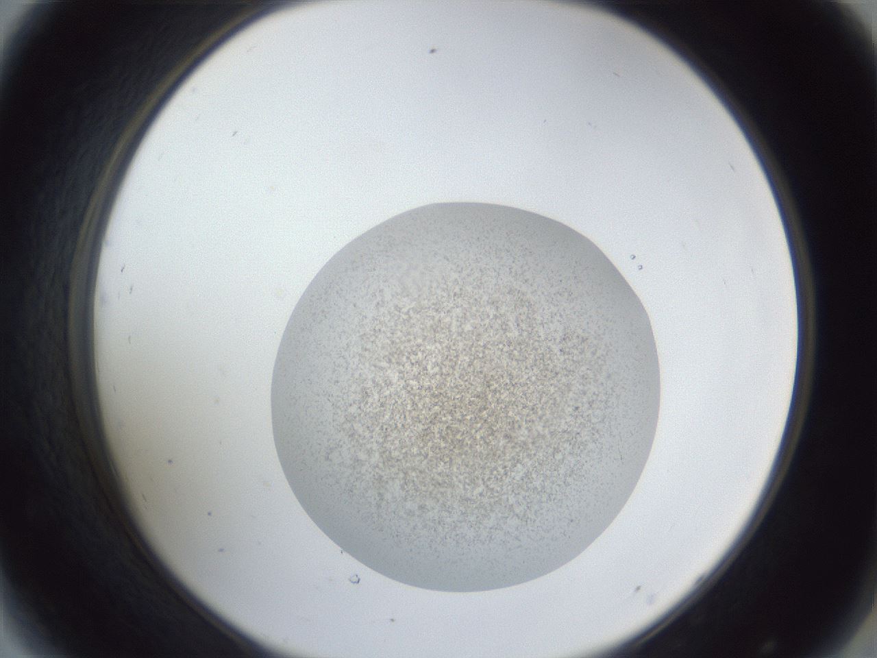 folderID252_plateID1252_batchID3920_wellNum44_profileID1_d2_r72549_ef.jpg