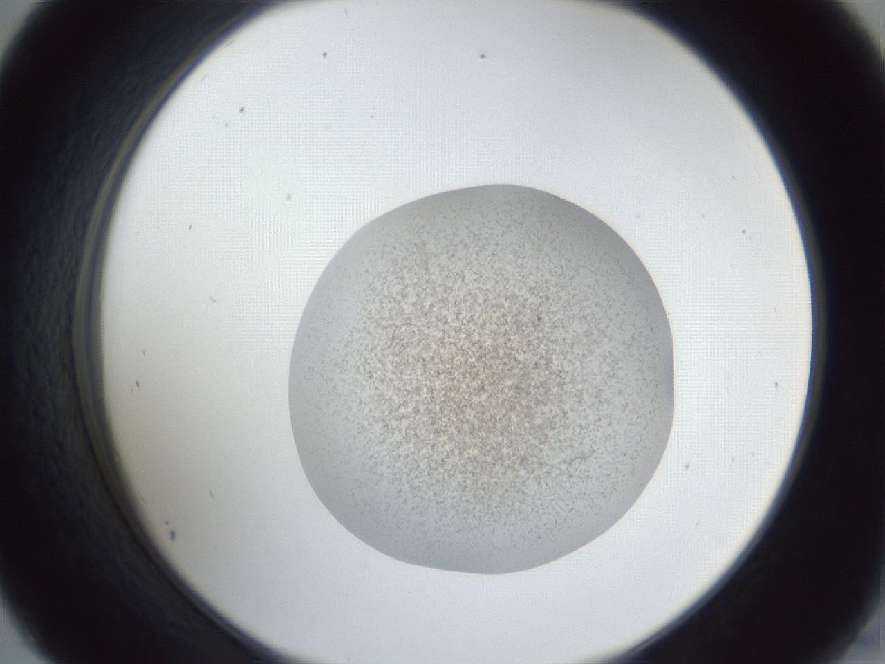 folderID252_plateID1252_batchID3920_wellNum45_profileID1_d2_r72551_ef.jpg