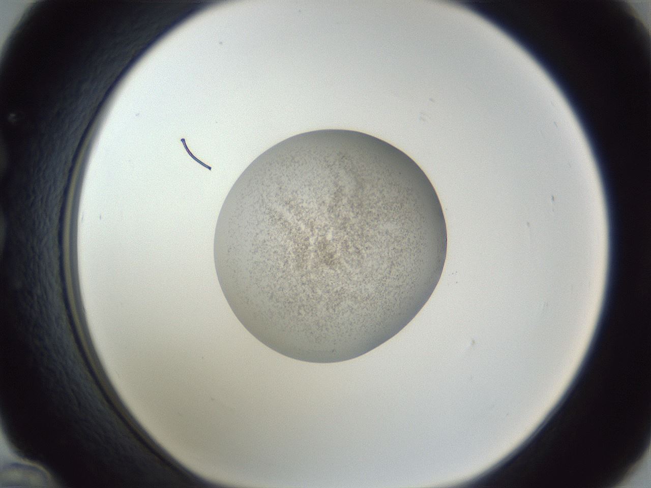 folderID252_plateID1252_batchID3920_wellNum36_profileID1_d1_r72532_ef.jpg