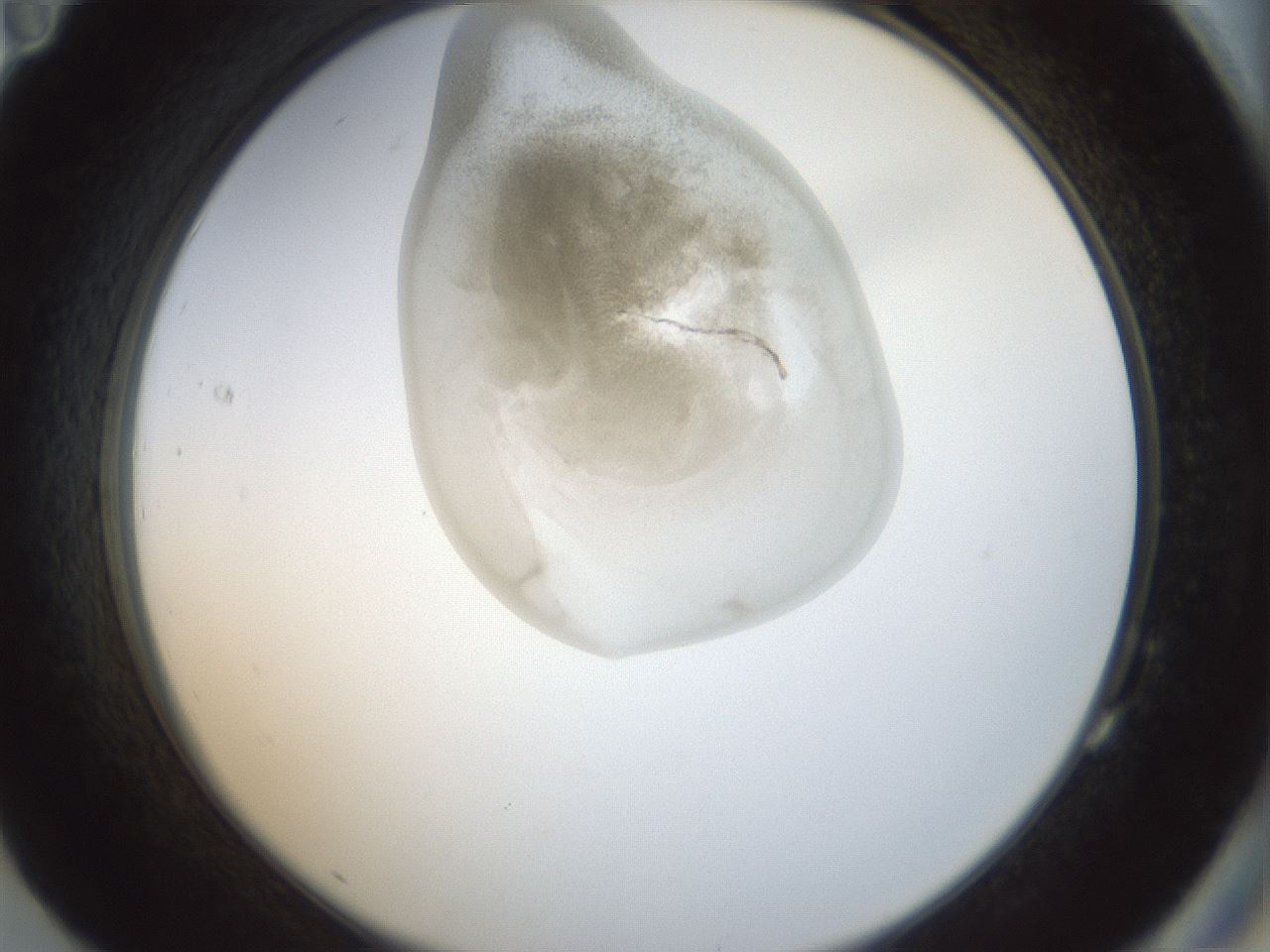 folderID154_plateID1154_batchID3121_wellNum83_profileID1_d2_r61058_ef.jpg