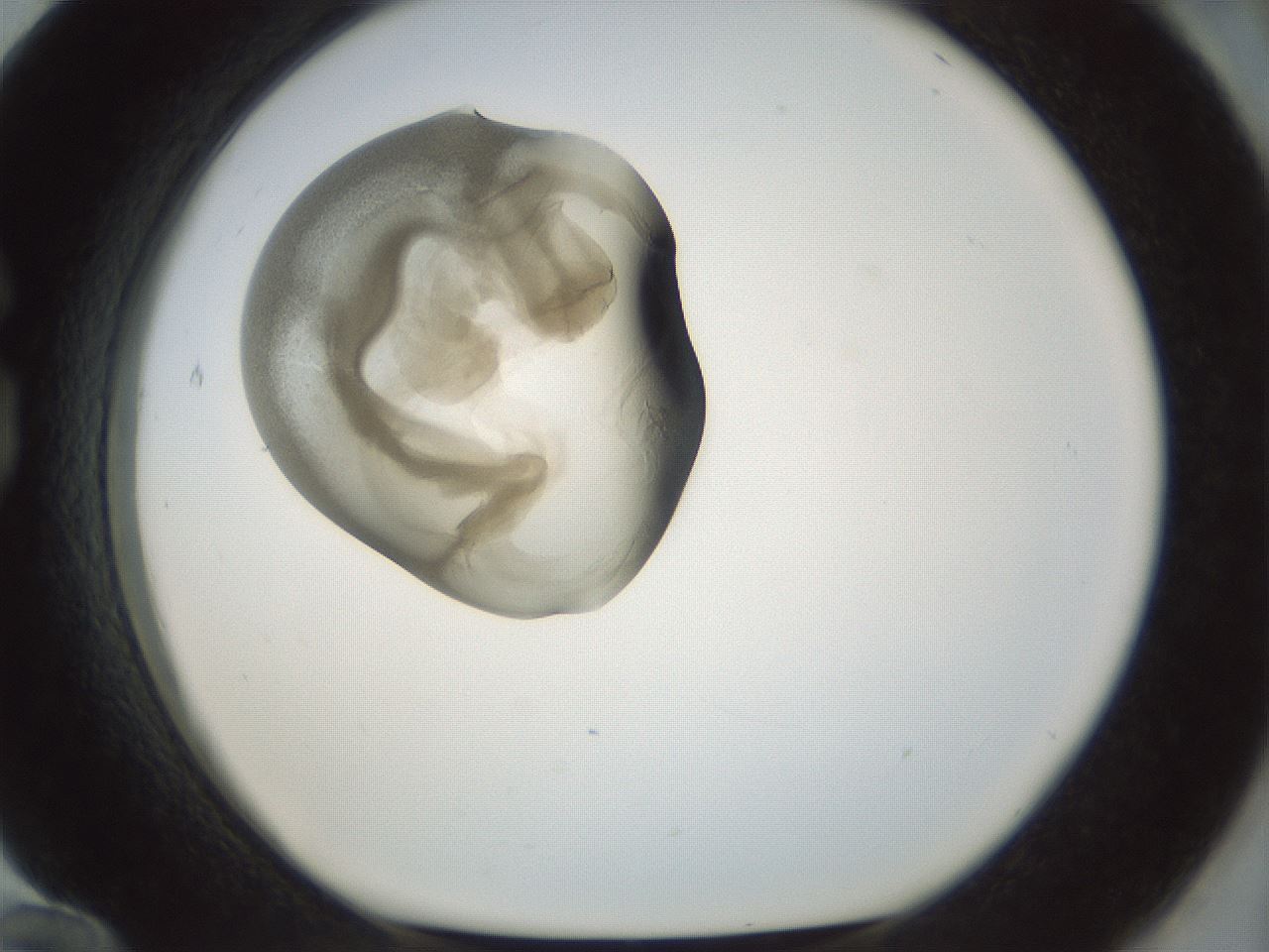 folderID154_plateID1154_batchID3121_wellNum84_profileID1_d1_r61059_ef.jpg