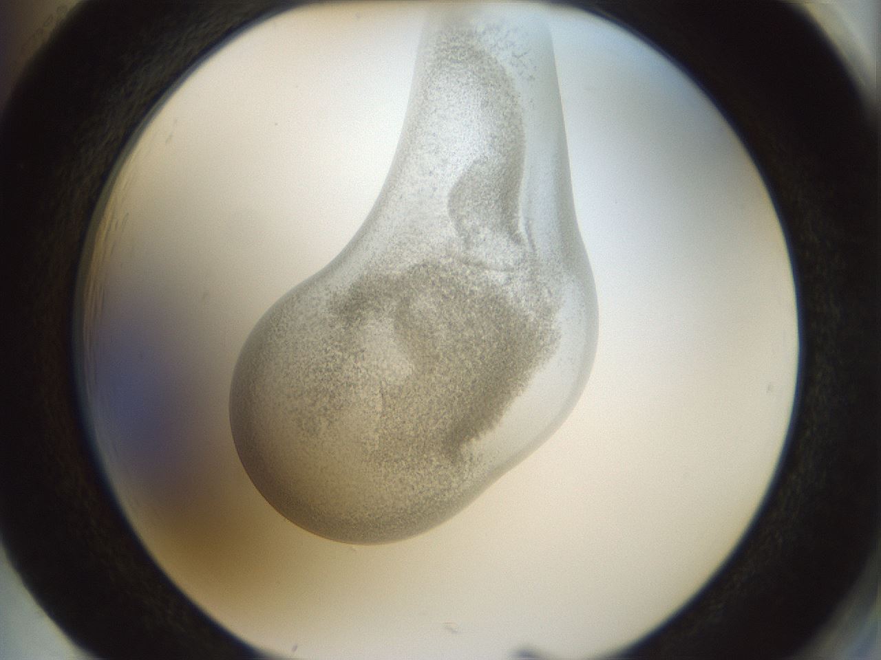 folderID154_plateID1154_batchID3121_wellNum85_profileID1_d2_r61062_ef.jpg
