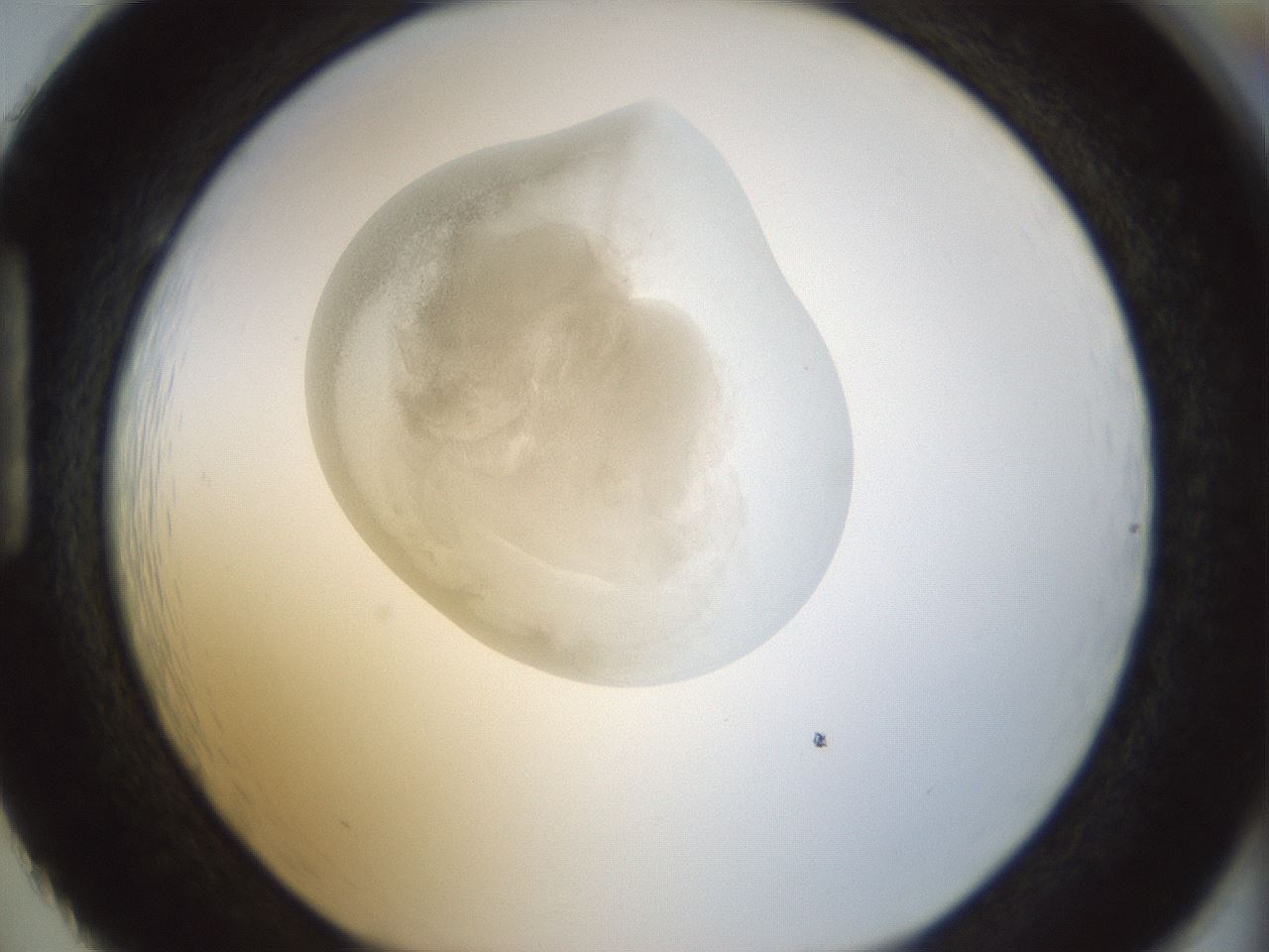 folderID154_plateID1154_batchID3121_wellNum86_profileID1_d1_r61063_ef.jpg