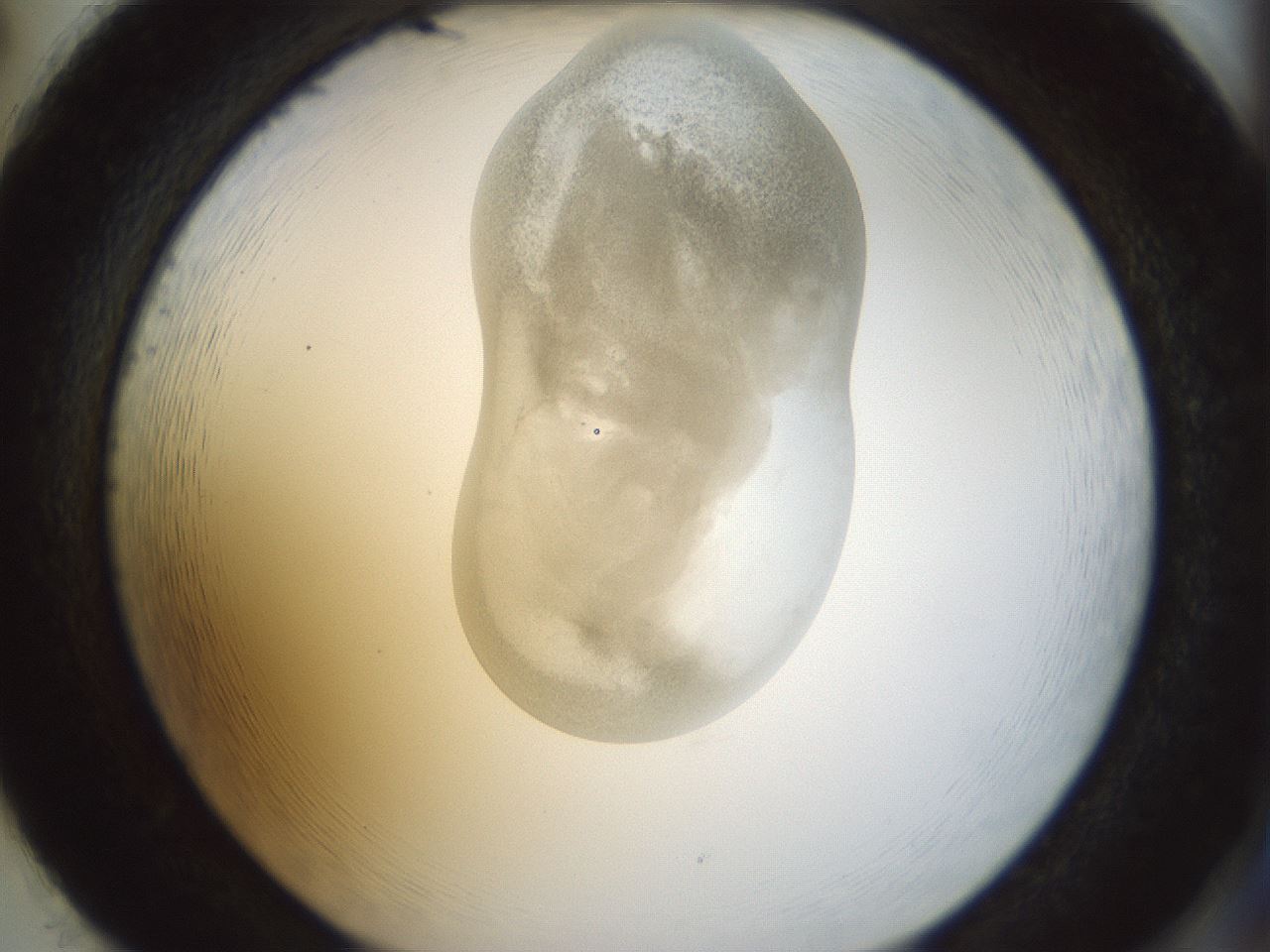 folderID154_plateID1154_batchID3121_wellNum86_profileID1_d2_r61064_ef.jpg