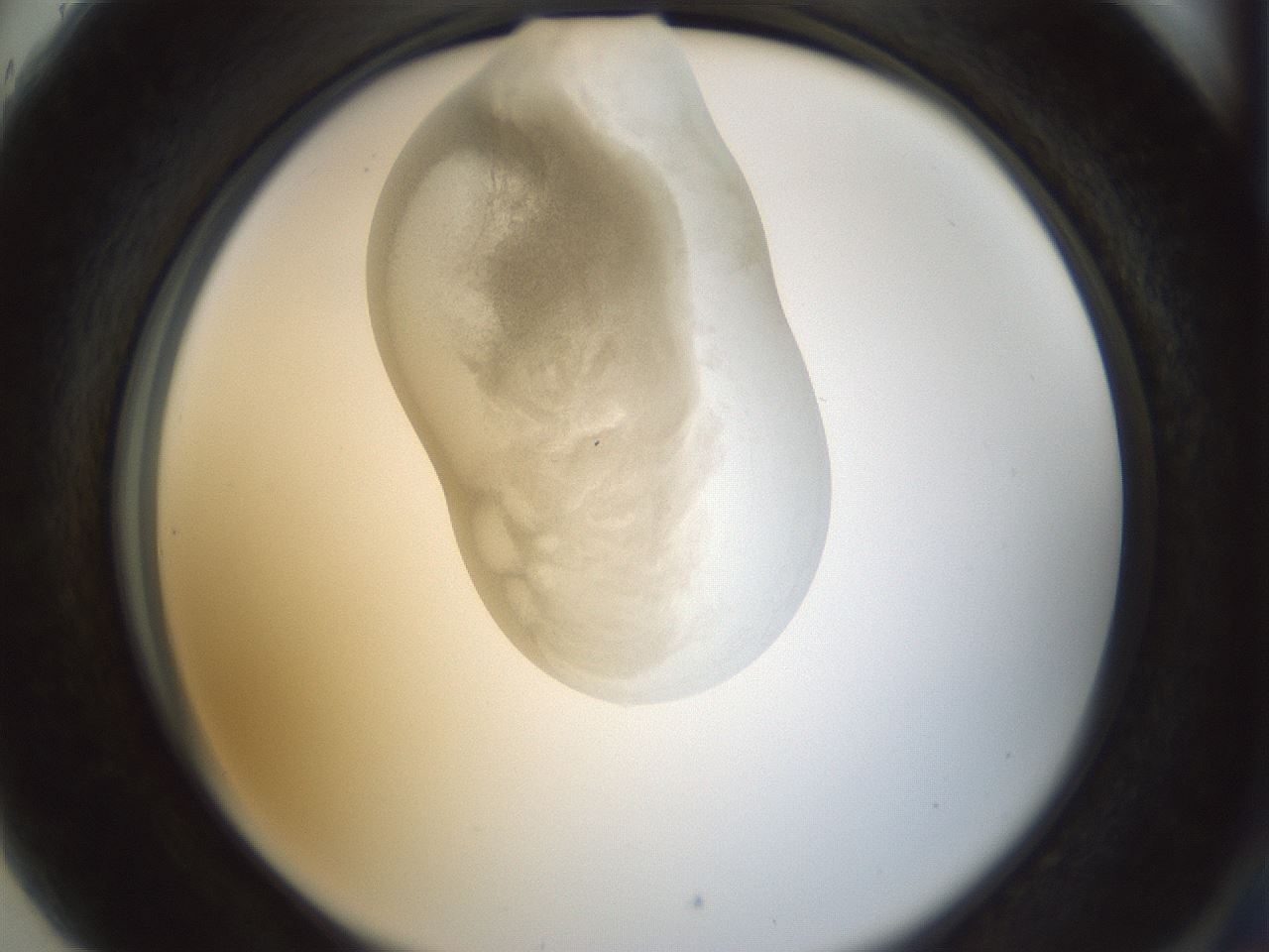 folderID154_plateID1154_batchID3121_wellNum89_profileID1_d2_r61070_ef.jpg