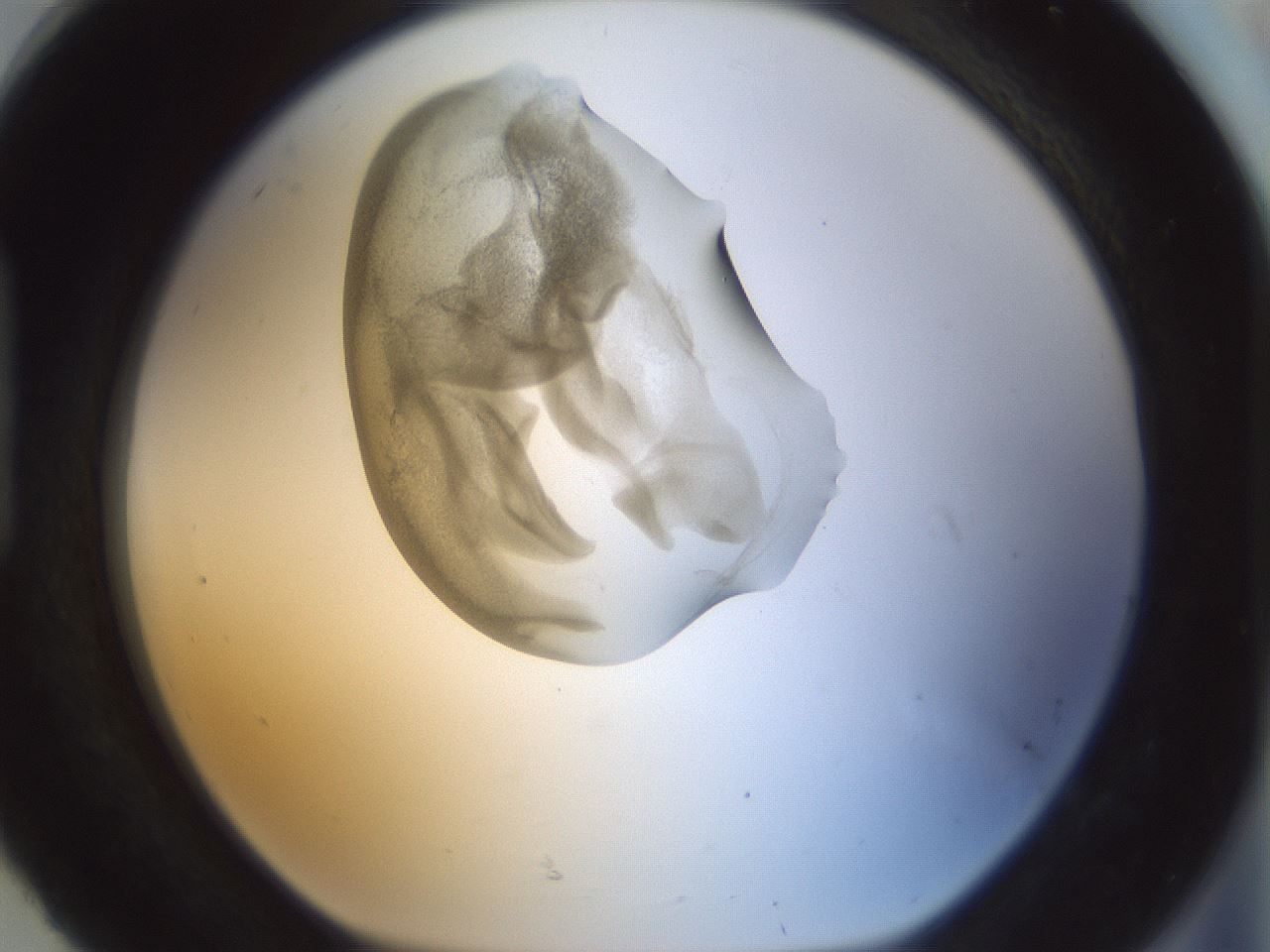 folderID154_plateID1154_batchID3121_wellNum92_profileID1_d1_r61075_ef.jpg