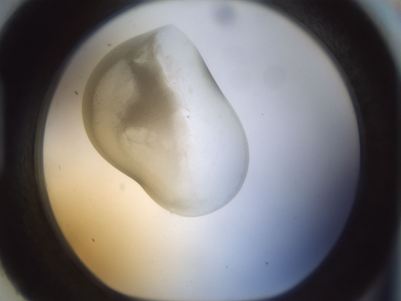 folderID154_plateID1154_batchID3121_wellNum93_profileID1_d1_r61077_ef.jpg
