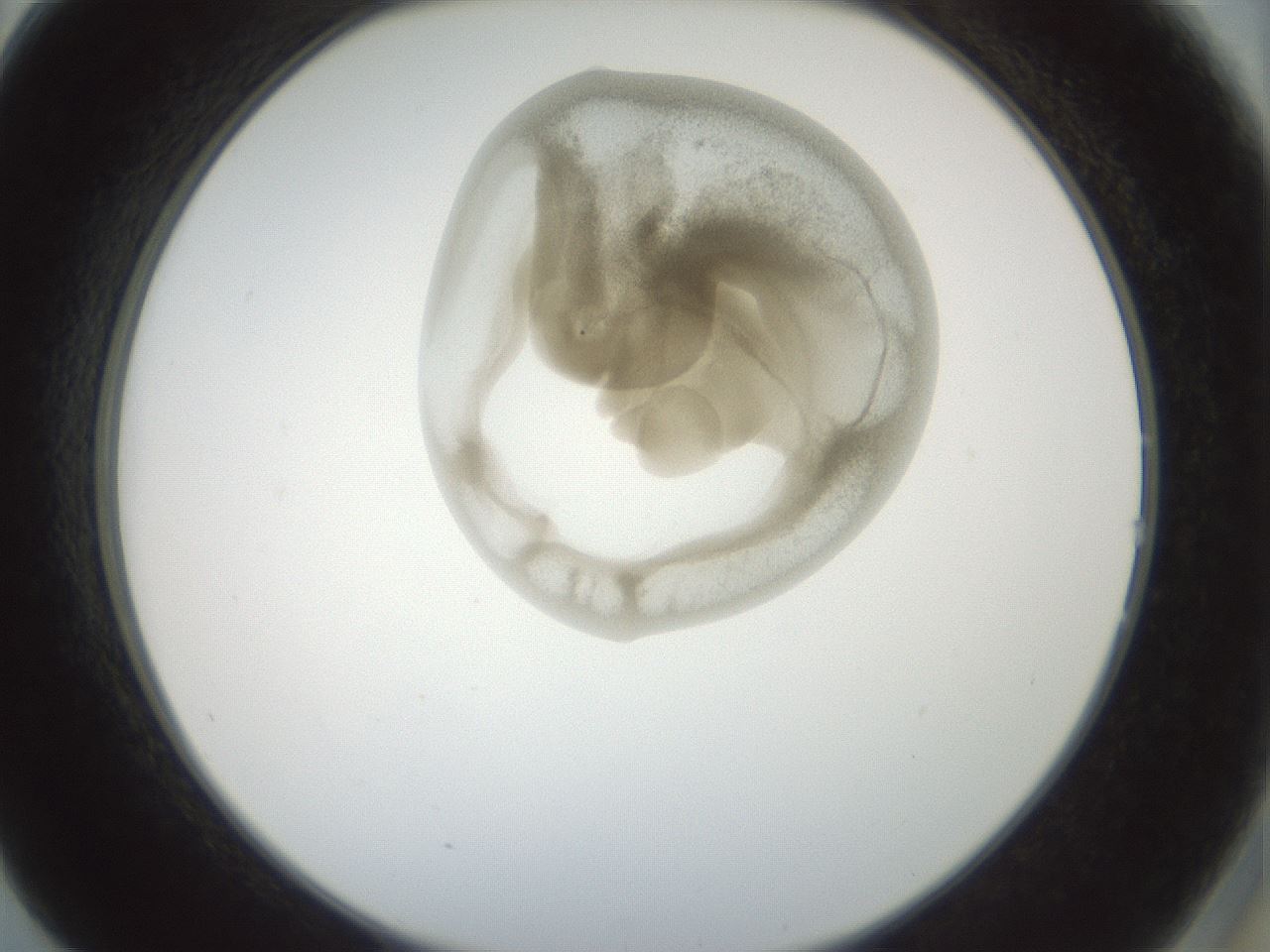 folderID155_plateID1155_batchID3205_wellNum14_profileID1_d2_r62458_ef.jpg