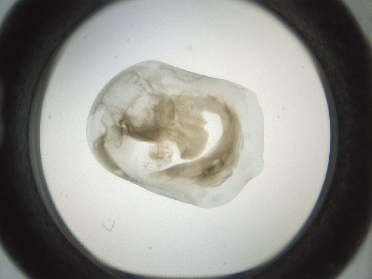 folderID155_plateID1155_batchID3205_wellNum16_profileID1_d1_r62461_ef.jpg