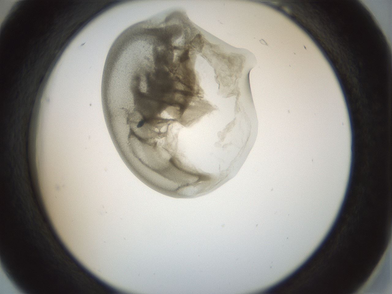 folderID155_plateID1155_batchID3205_wellNum18_profileID1_d2_r62466_ef.jpg