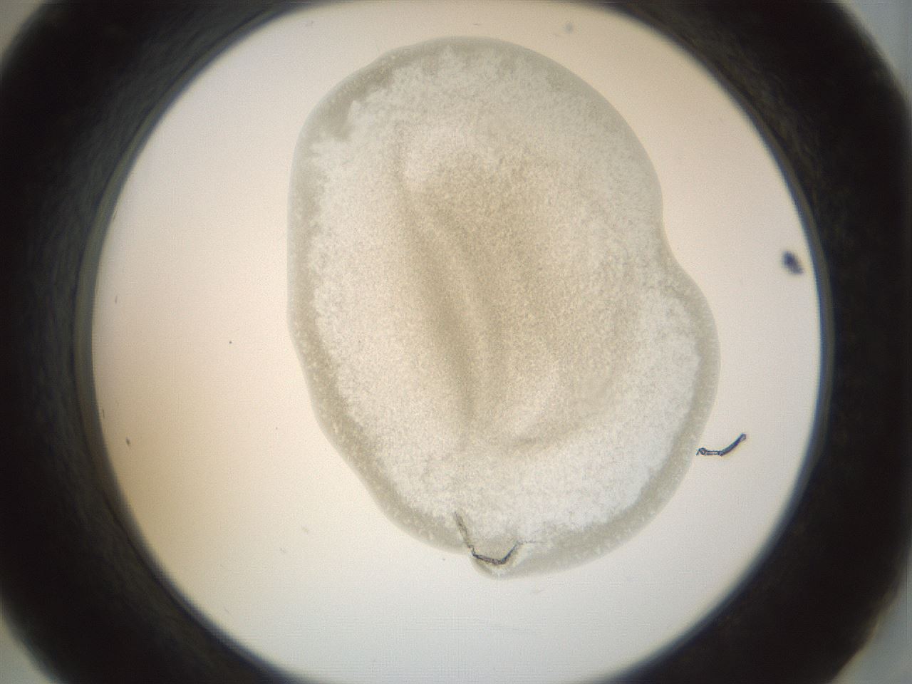 folderID155_plateID1155_batchID3205_wellNum21_profileID1_d2_r62472_ef.jpg