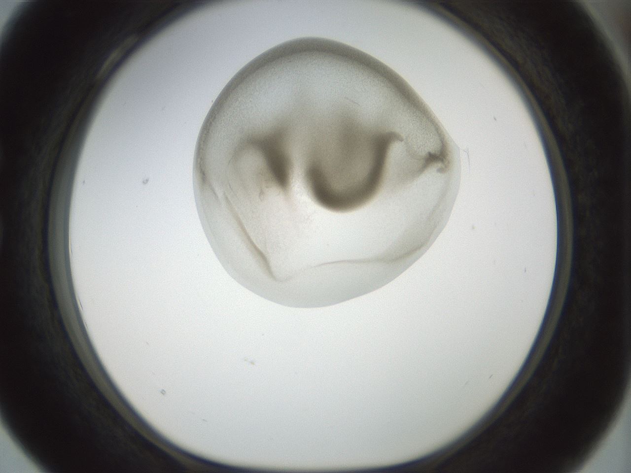 folderID155_plateID1155_batchID3205_wellNum28_profileID1_d1_r62485_ef.jpg