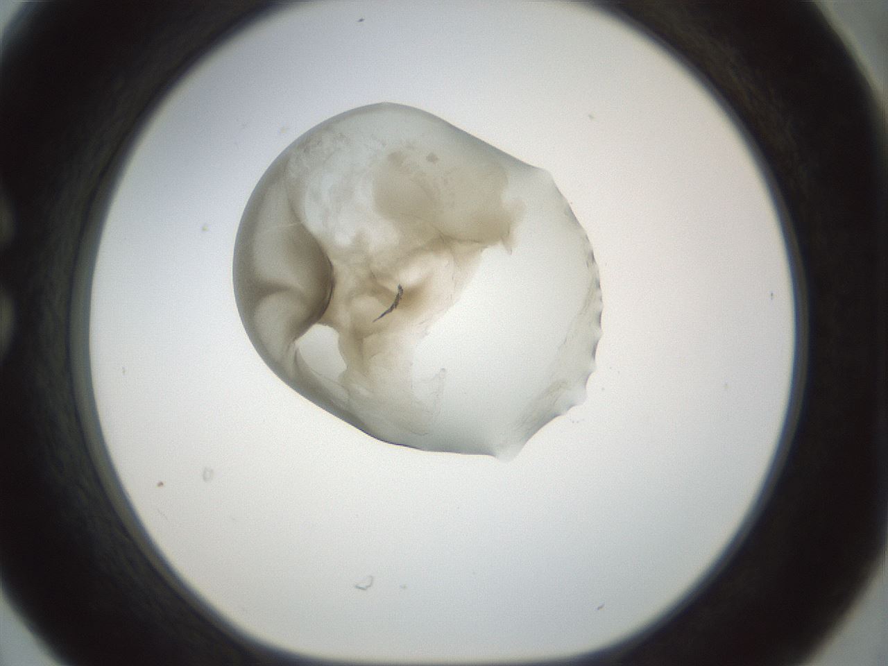 folderID155_plateID1155_batchID3205_wellNum30_profileID1_d1_r62489_ef.jpg