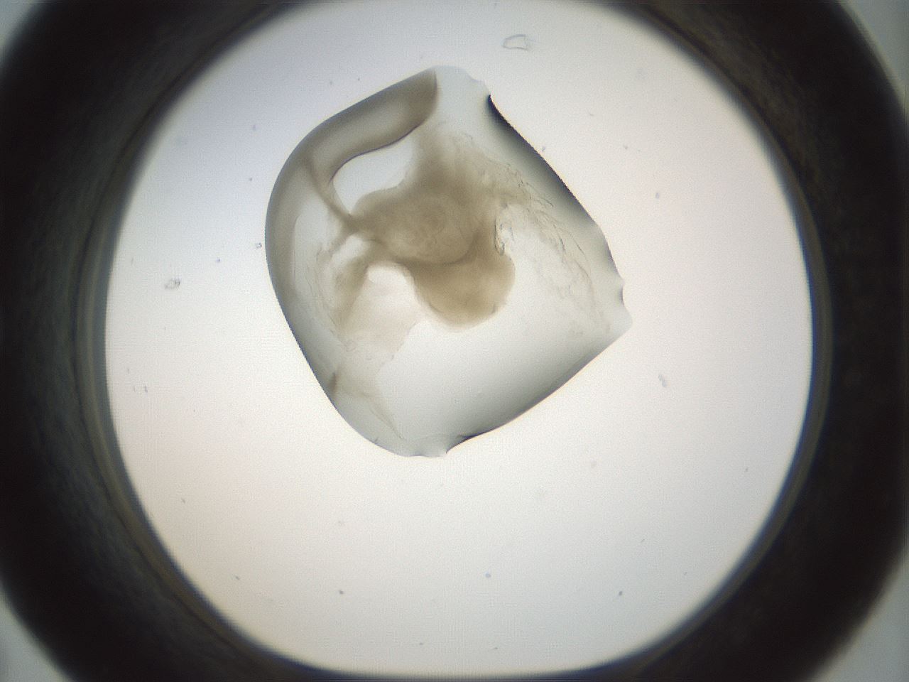 folderID155_plateID1155_batchID3205_wellNum31_profileID1_d1_r62491_ef.jpg