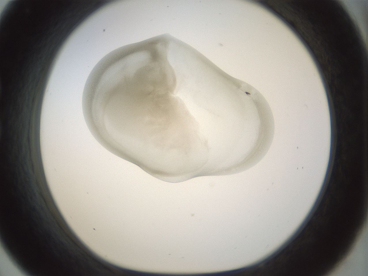 folderID155_plateID1155_batchID3205_wellNum33_profileID1_d1_r62495_ef.jpg
