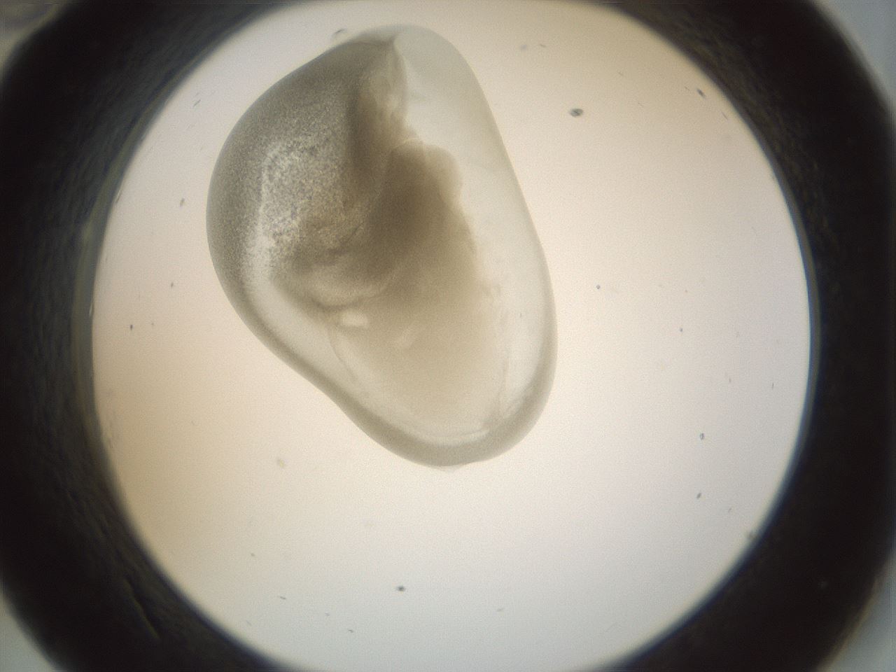 folderID155_plateID1155_batchID3205_wellNum34_profileID1_d2_r62498_ef.jpg
