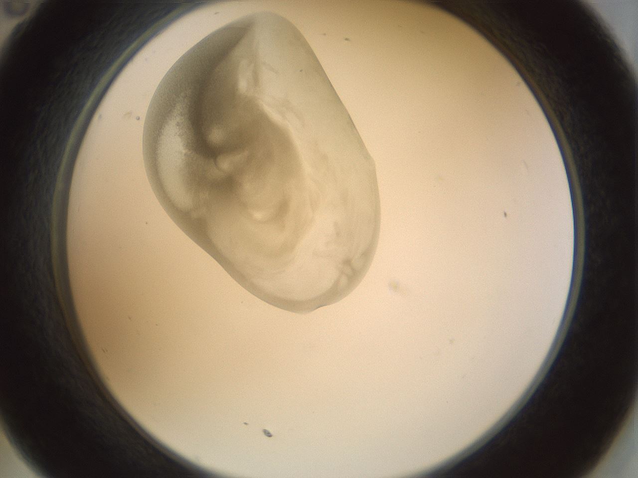 folderID155_plateID1155_batchID3205_wellNum35_profileID1_d2_r62500_ef.jpg