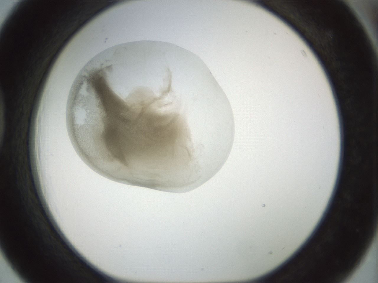folderID155_plateID1155_batchID3205_wellNum39_profileID1_d1_r62507_ef.jpg