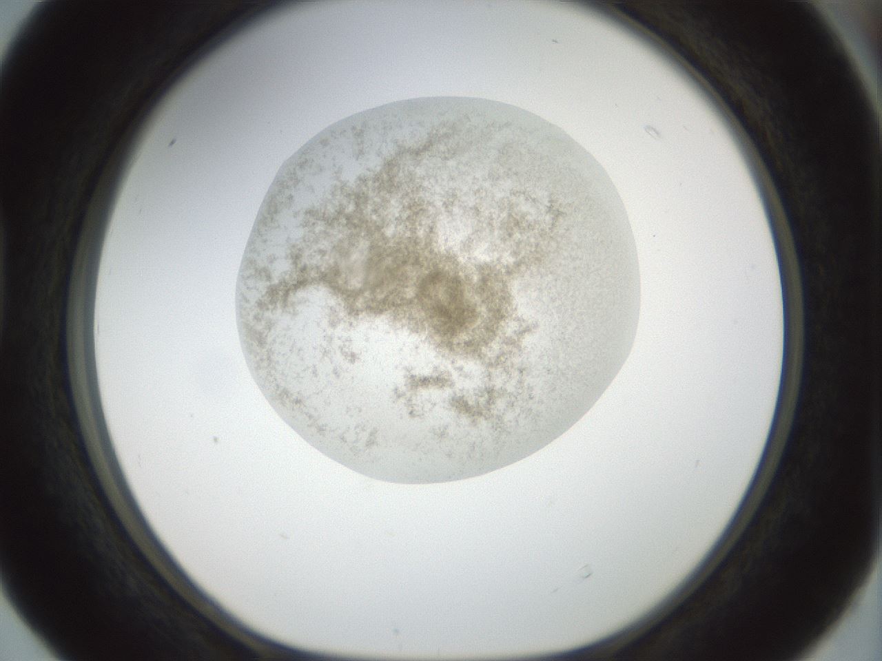 folderID155_plateID1155_batchID3205_wellNum40_profileID1_d1_r62509_ef.jpg