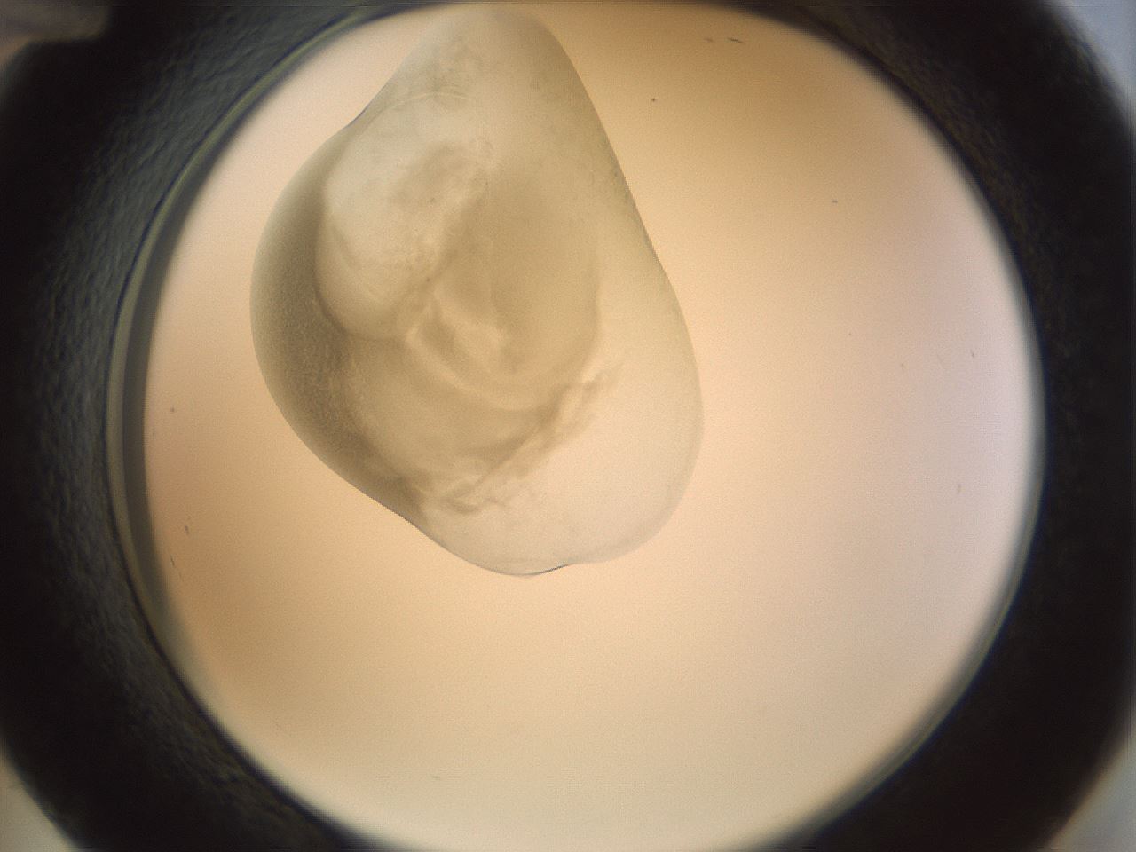 folderID155_plateID1155_batchID3205_wellNum48_profileID1_d2_r62526_ef.jpg
