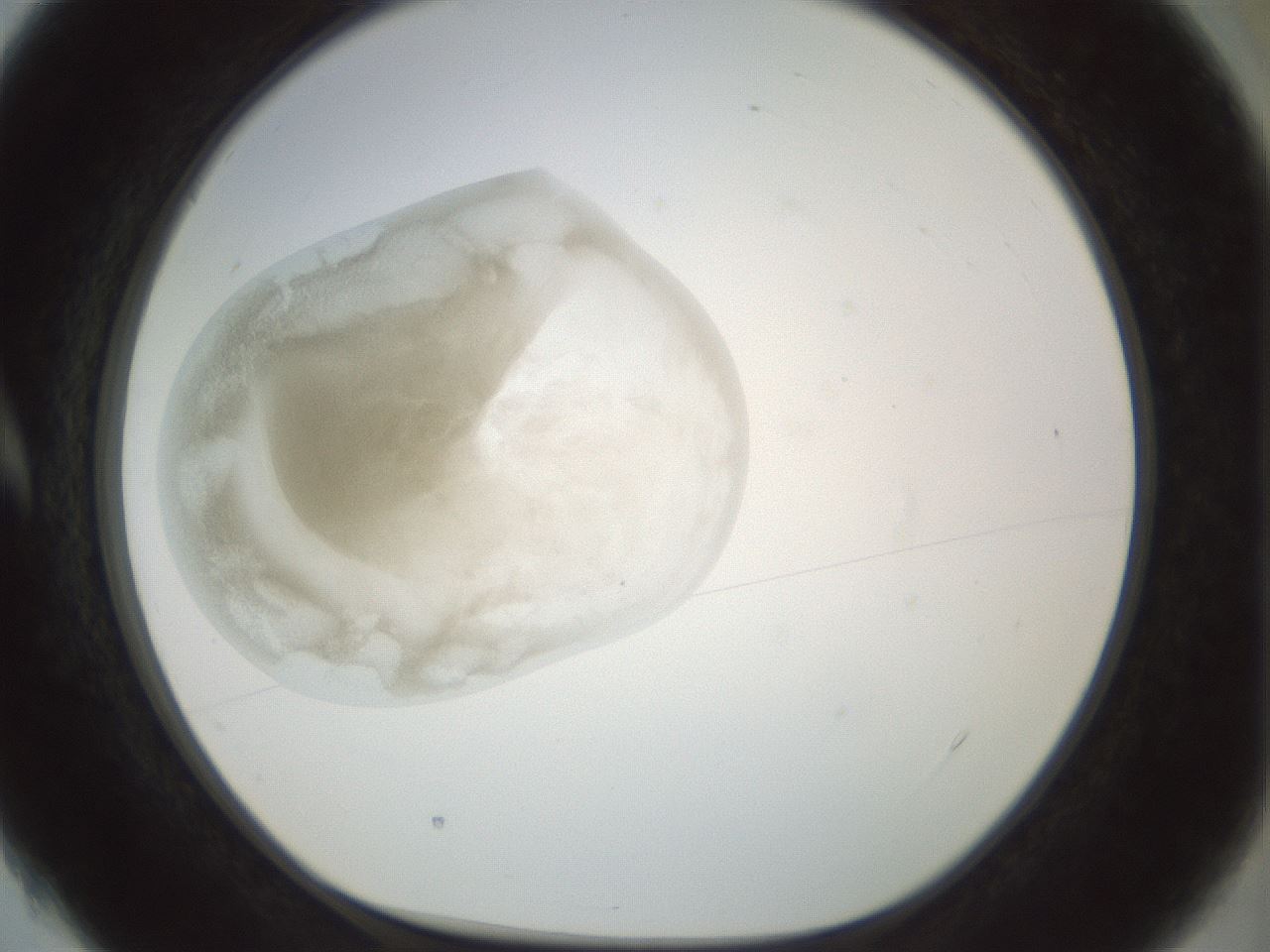 folderID155_plateID1155_batchID3205_wellNum4_profileID1_d1_r62437_ef.jpg