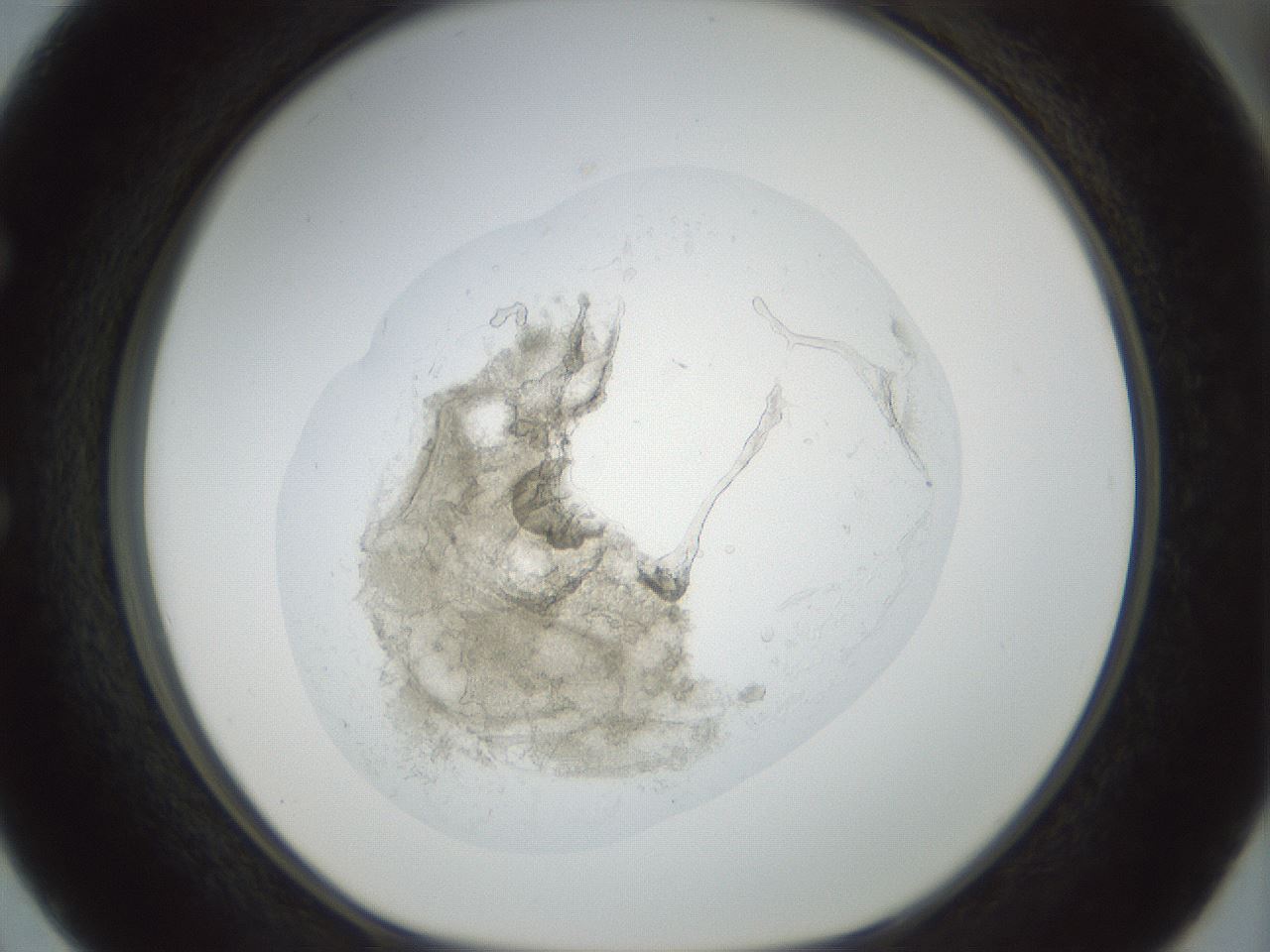 folderID155_plateID1155_batchID3205_wellNum50_profileID1_d1_r62529_ef.jpg